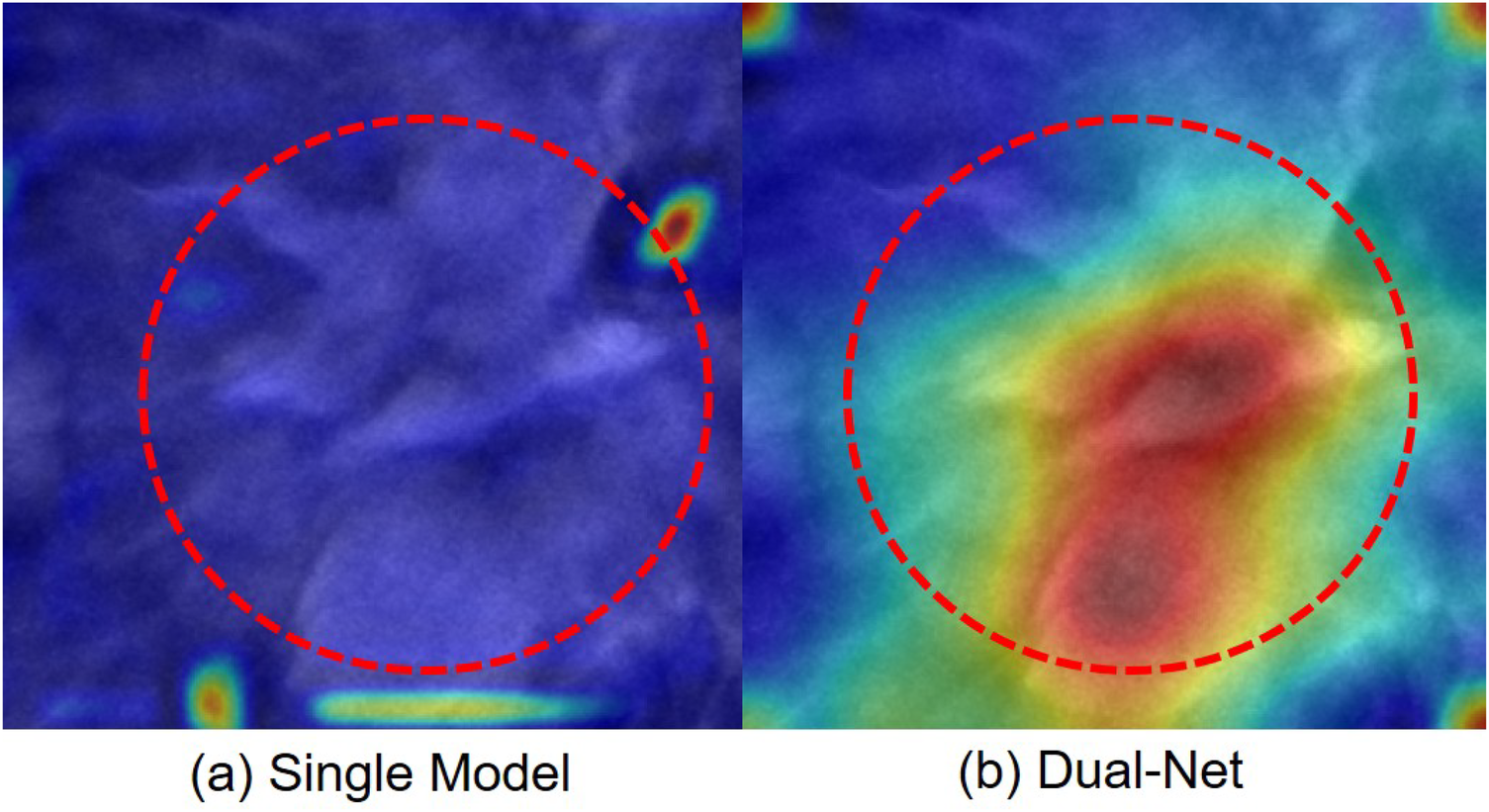 Comparison of two visualizations: (a) Single Model, showing mostly blue shades with minimal distinguishing features within a red dashed circle; (b) Dual-Net, with a clear red and yellow area within a red dashed circle indicating a focal point.