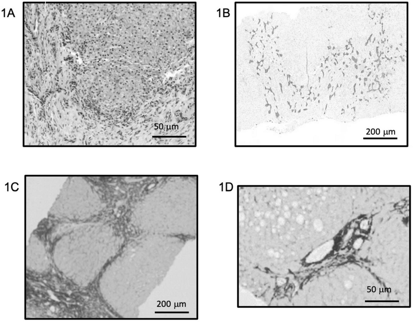 Four microscopic images of tissue samples, labeled 1A to 1D. Image 1A shows a dense cluster of cells at 50 micrometers. Image 1B displays a sparse tissue spread at 200 micrometers. Image 1C features interconnected structures at 200 micrometers. Image 1D reveals cellular formations with large voids at 50 micrometers.