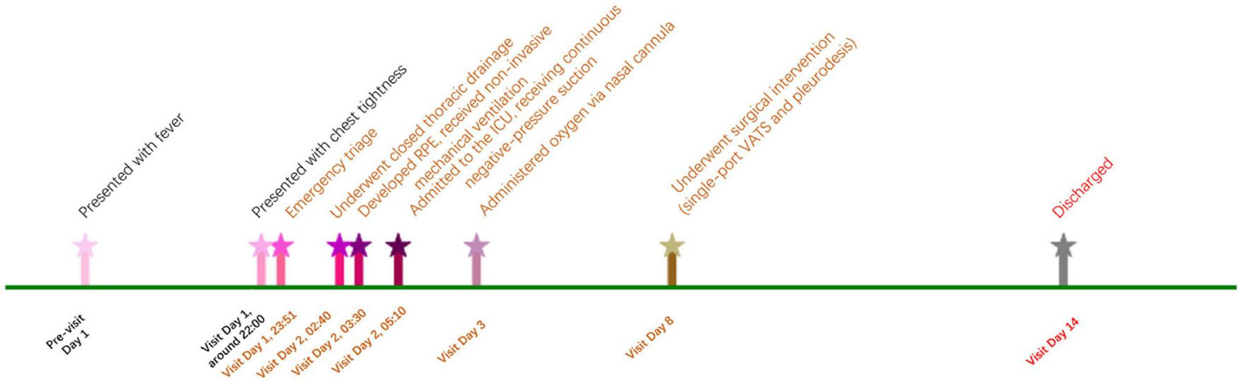 Timeline depicting a medical case from February 17 to March 3. Events include developing a fever and chest tightness, emergency visits, thoracic drainage, and ICU admission on February 18. Oxygen administration on February 20. A surgical intervention occurred on February 25. The patient was discharged on March 3.