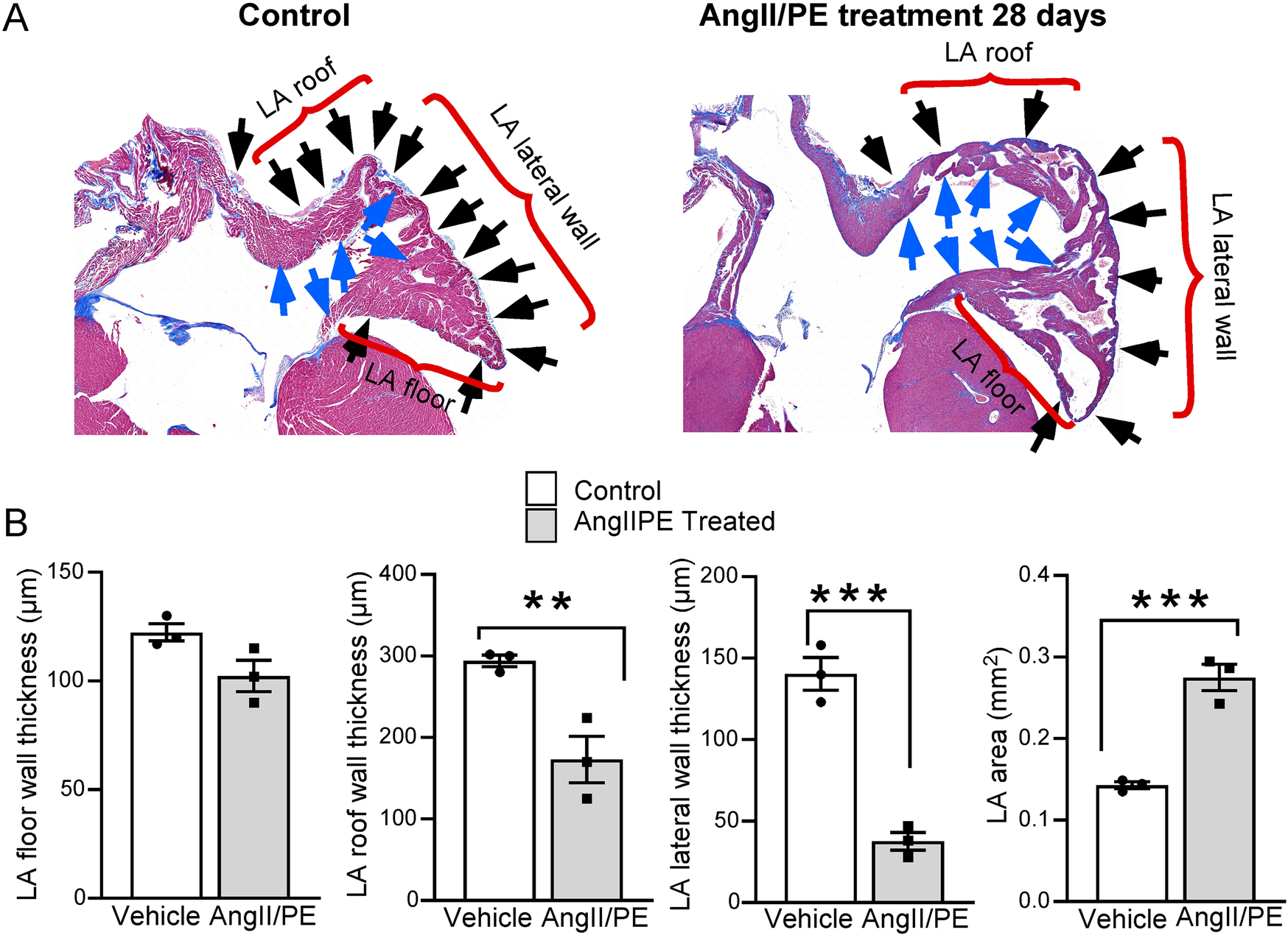 Histological analysis of cardiac tissue comparing control and AngII/PE treated mice at 28 days. Panel A shows two images of the left atrium (LA): on the left, a control sample with labeled regions including LA roof, lateral wall, and floor; on the right, a treated sample showing qualitative signs of LA wall thinning in above mentioned 3 regions. Panel B presents four bar graphs comparing LA floor wall thickness, LA roof wall thickness, LA lateral wall thickness, and LA area between control and treated groups. Statistical significance is indicated, with symbols ** and ***. The legend distinguishes control (white) and treated (gray) colors.