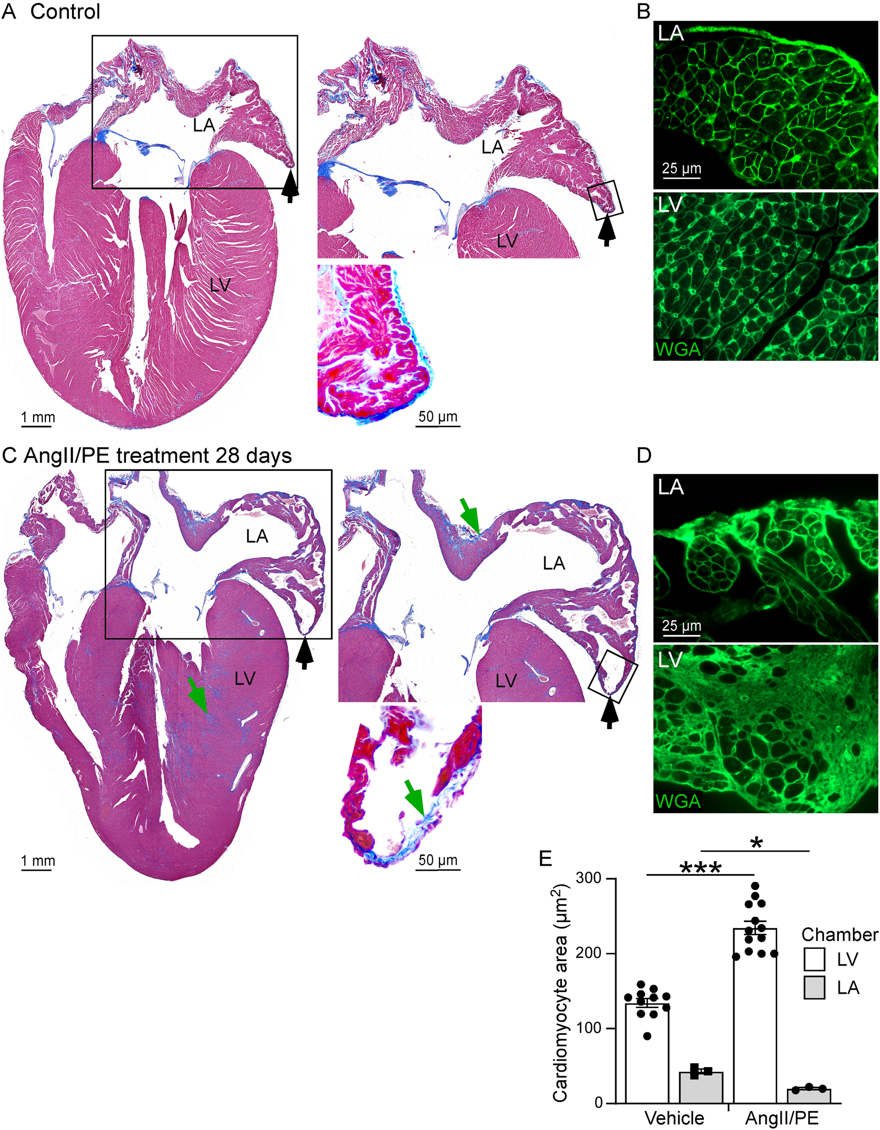 Histological comparison of mouse hearts. Panel A, C: Control vs AngII/PE treated animals showing sections of 4 chambers of the heart with left atrium (LA) detailed at higher magnification. Panel B, D: Fluorescent images of LA and LV showing cardiomyocyte size and structure in the LA and LV of control and AngII/PE treated animals. Panel E: Graph showing quantitative analysis of the myocardium demonstrating increased cardiomyocyte area in AngII/PE treatment compared to controls, with significant differences indicated by asterisks.