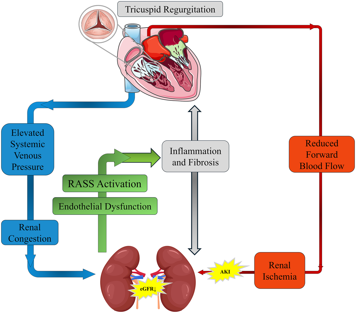 Diagram illustrating the pathway of tricuspid regurgitation leading to renal impairment. It shows tricuspid regurgitation causing elevated systemic venous pressure and reduced forward blood flow, resulting in renal congestion and ischemia. This leads to inflammation, fibrosis, RASS activation, and endothelial dysfunction, ultimately causing decreased glomerular filtration rate (eGFR), acute kidney injury (AKI), and renal ischemia.