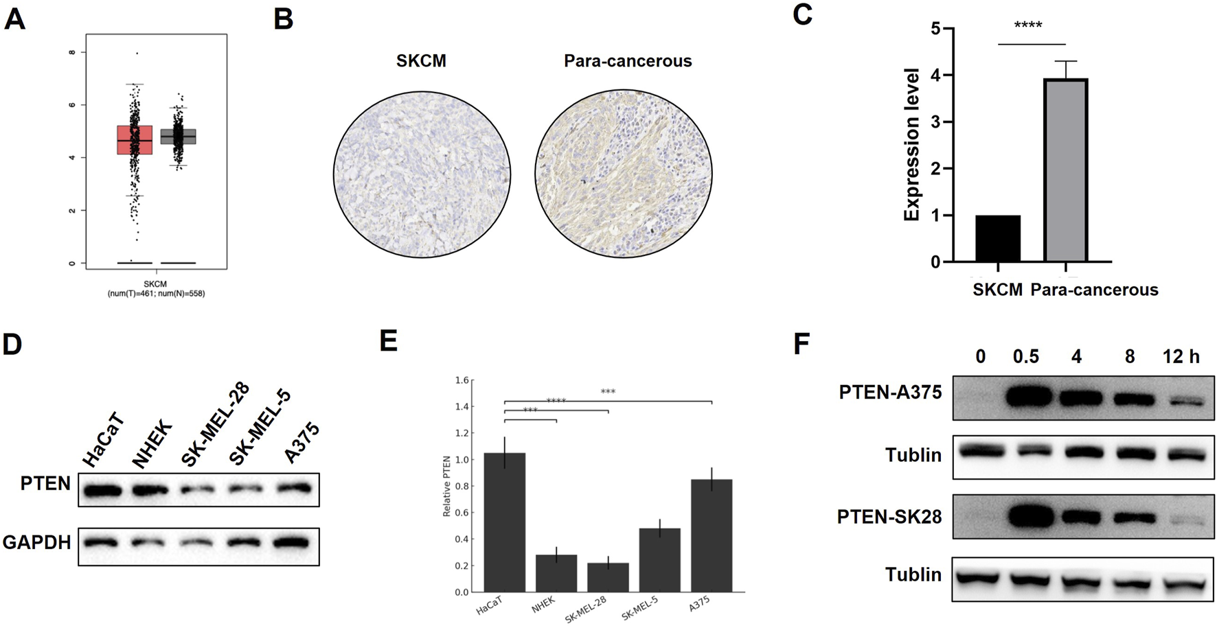 Panel A shows a box plot comparing SKCM and para-cancerous samples. Panel B presents two tissue stain images, one each of SKCM and para-cancerous tissues. Panel C features a bar graph demonstrating higher expression levels in para-cancerous samples compared to SKCM. Panel D displays a Western blot for PTEN across different cell lines with GAPDH as a loading control. Panel E includes a bar graph comparing relative PTEN expression in various cell lines. Panel F shows time-course Western blots of PTEN expressions in A375 and SK28 cells with Tubulin as a control.