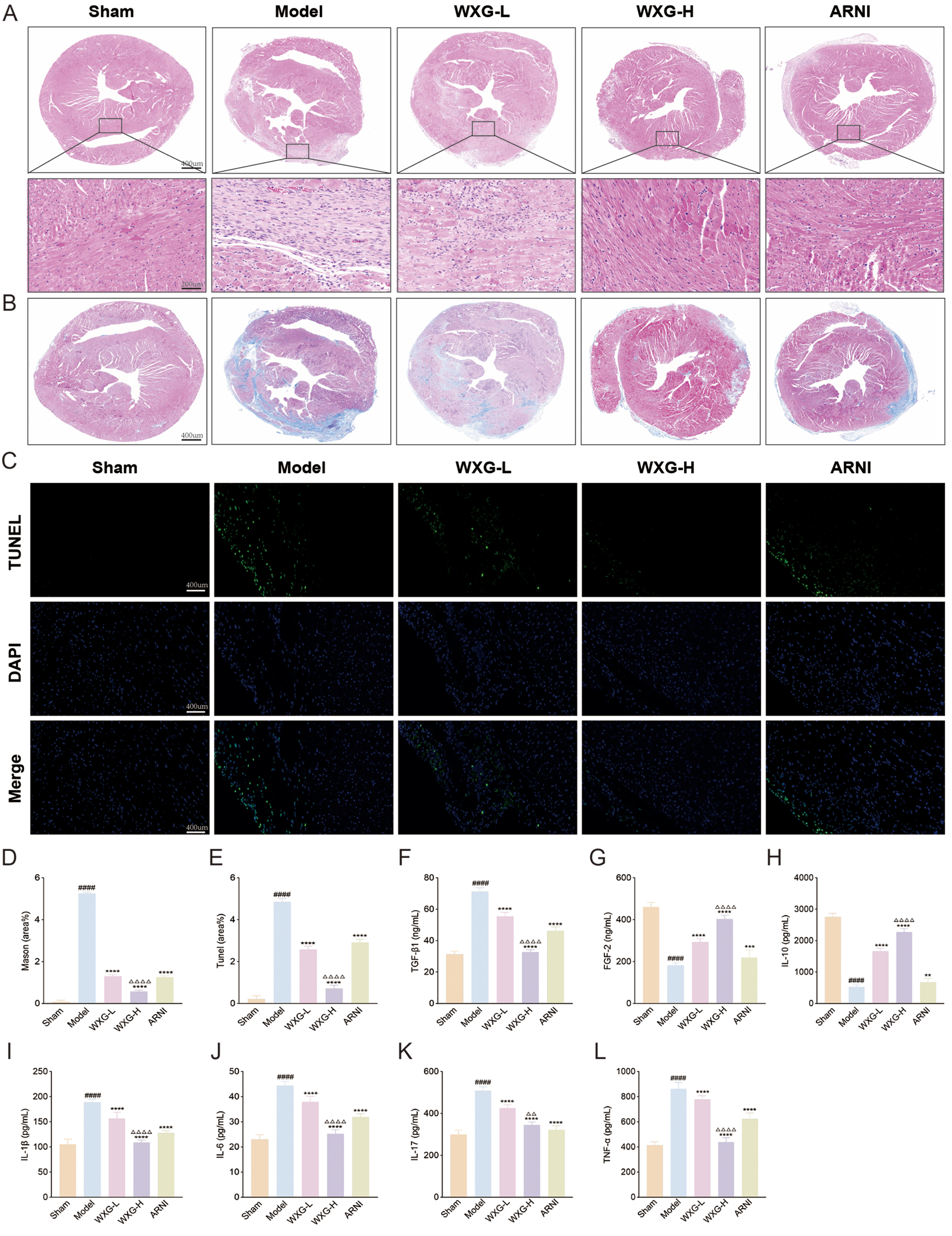 Histological analysis of heart tissue across five groups: Sham, Model, WXG-L, WXG-H, and ARNI, with panels A and B showing tissue staining and fibrosis, and panel C showing TUNEL and DAPI staining. Panels D to L present bar graphs comparing various expression levels of markers and cytokines among the groups. Each group is listed along the x-axis, indicating differences in expression or condition.