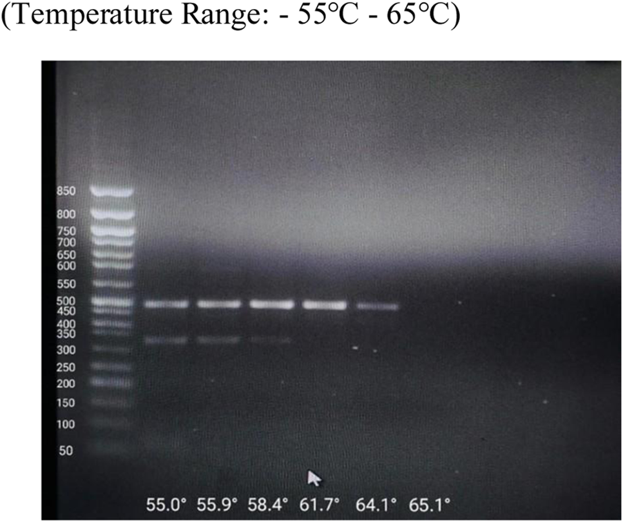Gel electrophoresis image showing DNA bands at various temperatures ranging from fifty-five degrees Celsius to sixty-five point one degrees Celsius. The left side displays a molecular weight ladder with bands from fifty to eight hundred and fifty base pairs. Vertical lanes show DNA samples at different temperatures.