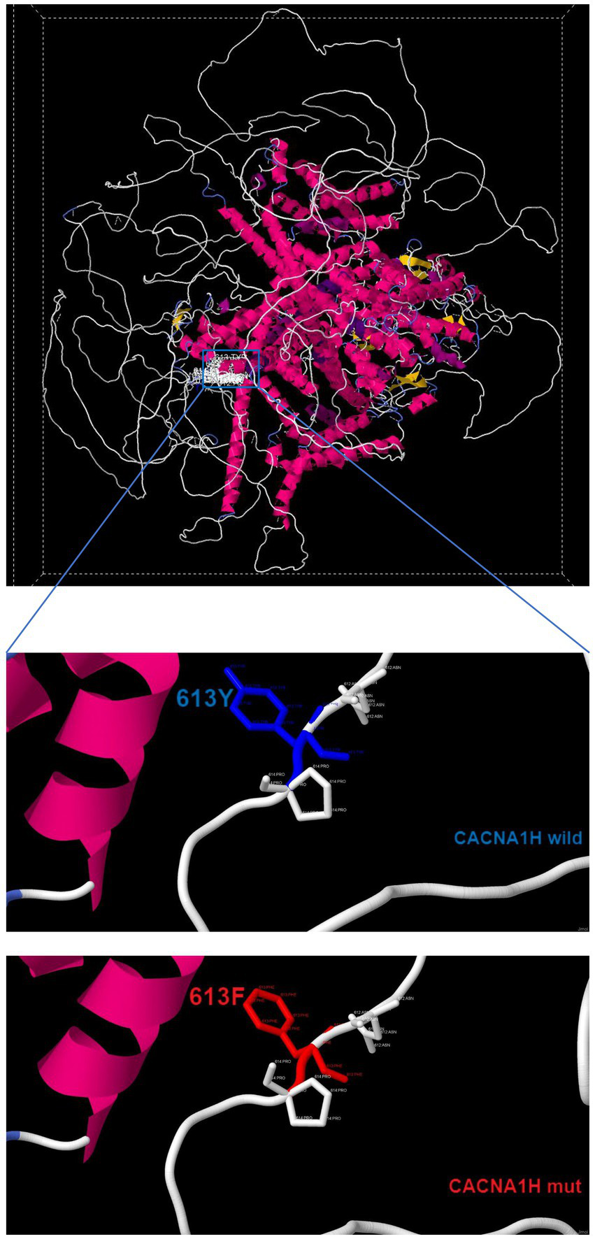 Molecular structure in three sections: the top shows a detailed protein model with pink helices, white lines, and yellow sheets. The middle and bottom sections zoom in on specific areas, comparing CACNA1H wild type (with a blue segment labeled 613Y) and a mutant (with a red segment labeled 613F). The structure highlights differences in amino acid sequences.