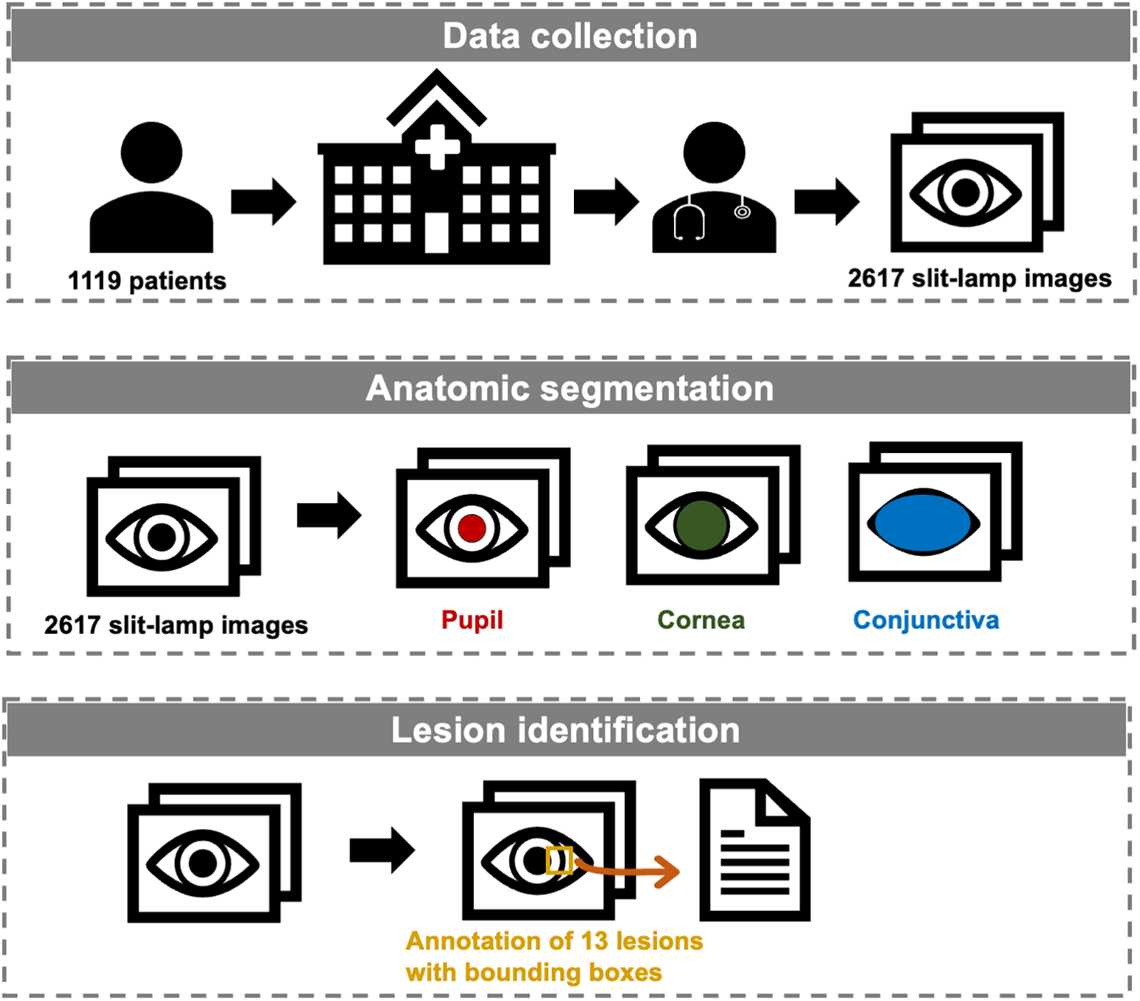 Workflow of the establishment of the slit-lamp dataset. \n\nTop section: \"Data collection\" A total of 2,617 ocular surface slit-lamp images were retrospectively collected from 1,119 patients. \n\nMiddle section: \"Anatomic segmentation\" The pupil, cornea, and conjunctiva regions in 2,617 slit-lamp images were annotated separately. \n\nBottom section: \"Lesion identification\" Lesion regions in 2,617 slit-lamp images were annotated using bounding boxes, covering 13 types of lesions.
