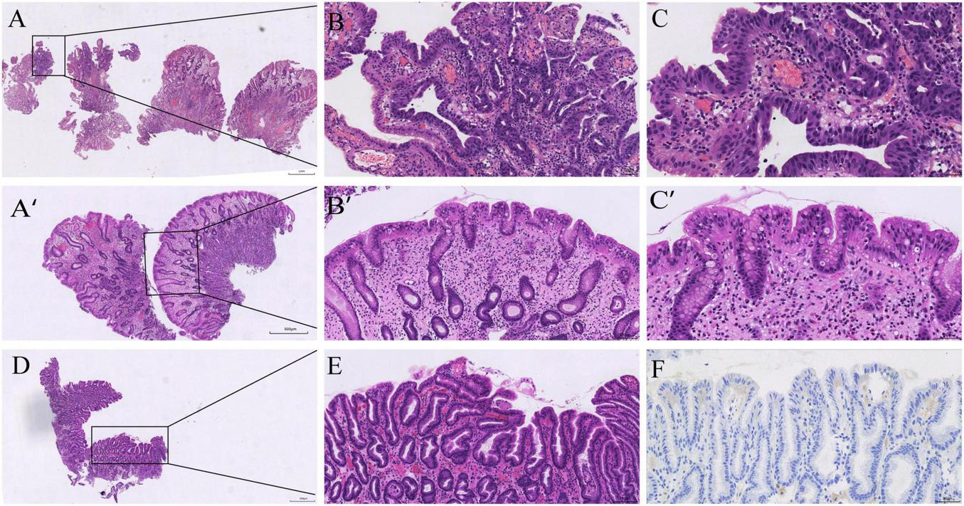 Histological slides showing tissue samples. Panels A and A’ depict large-scale images of tissue with highlighted sections. Panels B, B’, C, C’, E, and F display closer views of tissue structures, stained to reveal cellular details. Panel D shows a section with a highlighted area. Panel F exhibits a different staining technique, possibly immunohistochemistry, emphasizing certain structures.