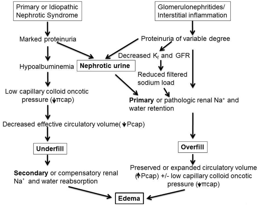 Нефротический синдром чаще встречается при малярии. Нефротический синдром патогенез отеков. Нефритический синдром патогенез схема. Схема патогенеза нефротического синдрома. Нефротический синдром патогенез патофизиология.
