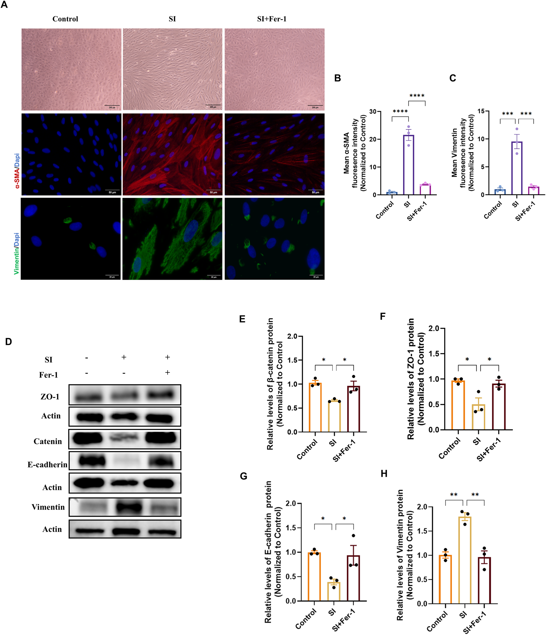 Panel A shows cell morphology under three conditions: control, SI, and SI+Fer-1; with brightfield, αSMA (red)/DAPI (blue) immunofluorescence, and vimentin (green)/DAPI (blue) staining rows. Panels B and C display bar graphs quantifying mean αSMA and vimentin fluorescence intensities. Panel D presents western blot bands of ZO-1, β-catenin, E-cadherin, vimentin, and actin under the three treatments. Panels E-H are bar graphs quantifying protein expression from the blots for β-catenin, ZO-1, E-cadherin, and vimentin, respectively. Statistical significance is indicated by asterisks.