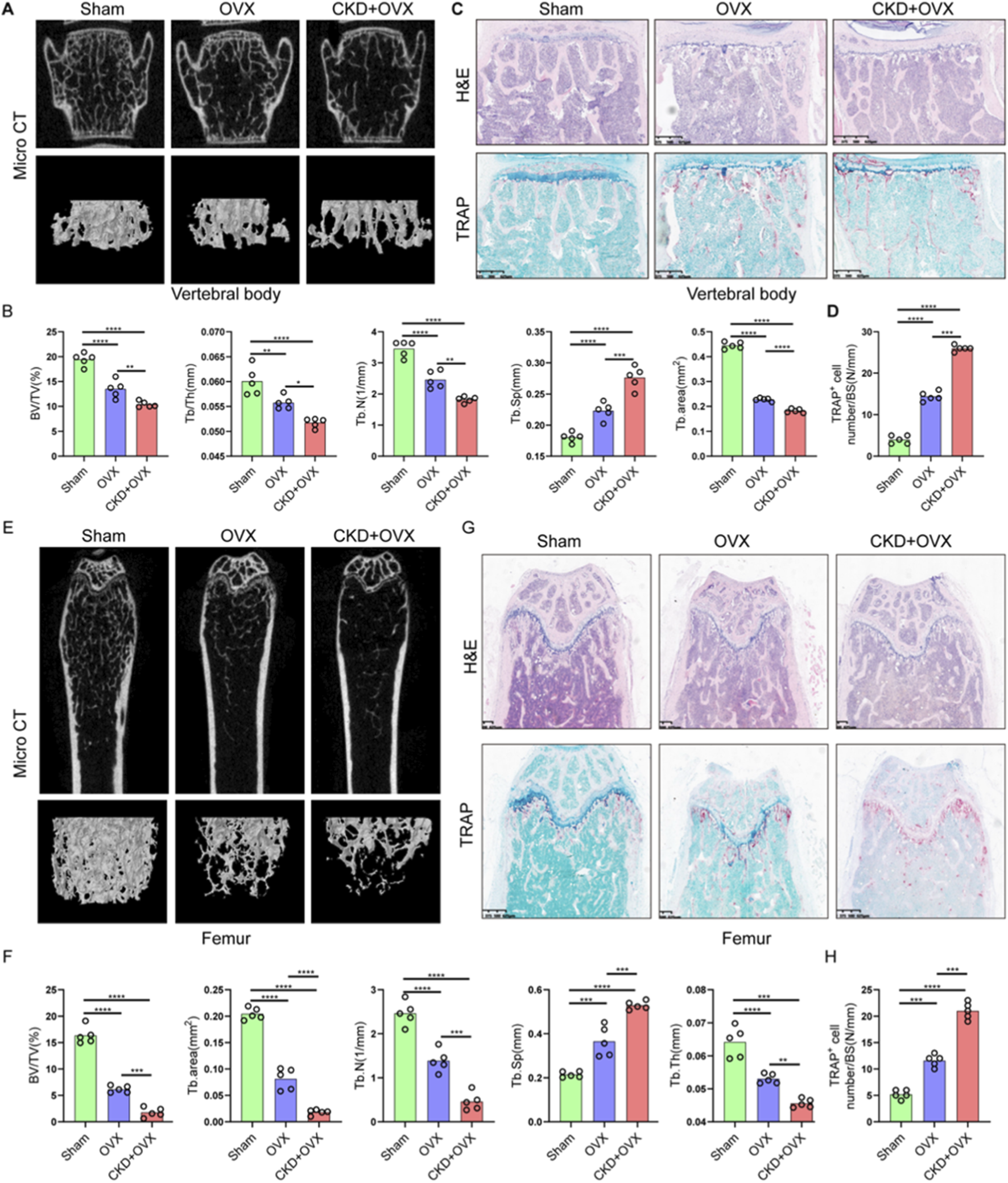 Micro-CT and histological analyses of vertebral bodies and femurs in sham, OVX, and CKD+OVX groups. Images A and E show micro-CT scans for bone structure. Panels B and F present corresponding graphs displaying bone volume, trabecular number, and thickness differences across groups. Histological images C and G show H&E and TRAP staining highlighting cellular and mineral changes. Graphs D and H quantify TRAP-positive cells, showing significant differences. Groups are visually and statistically compared, indicating alterations in bone architecture and cellular activity due to different treatments.