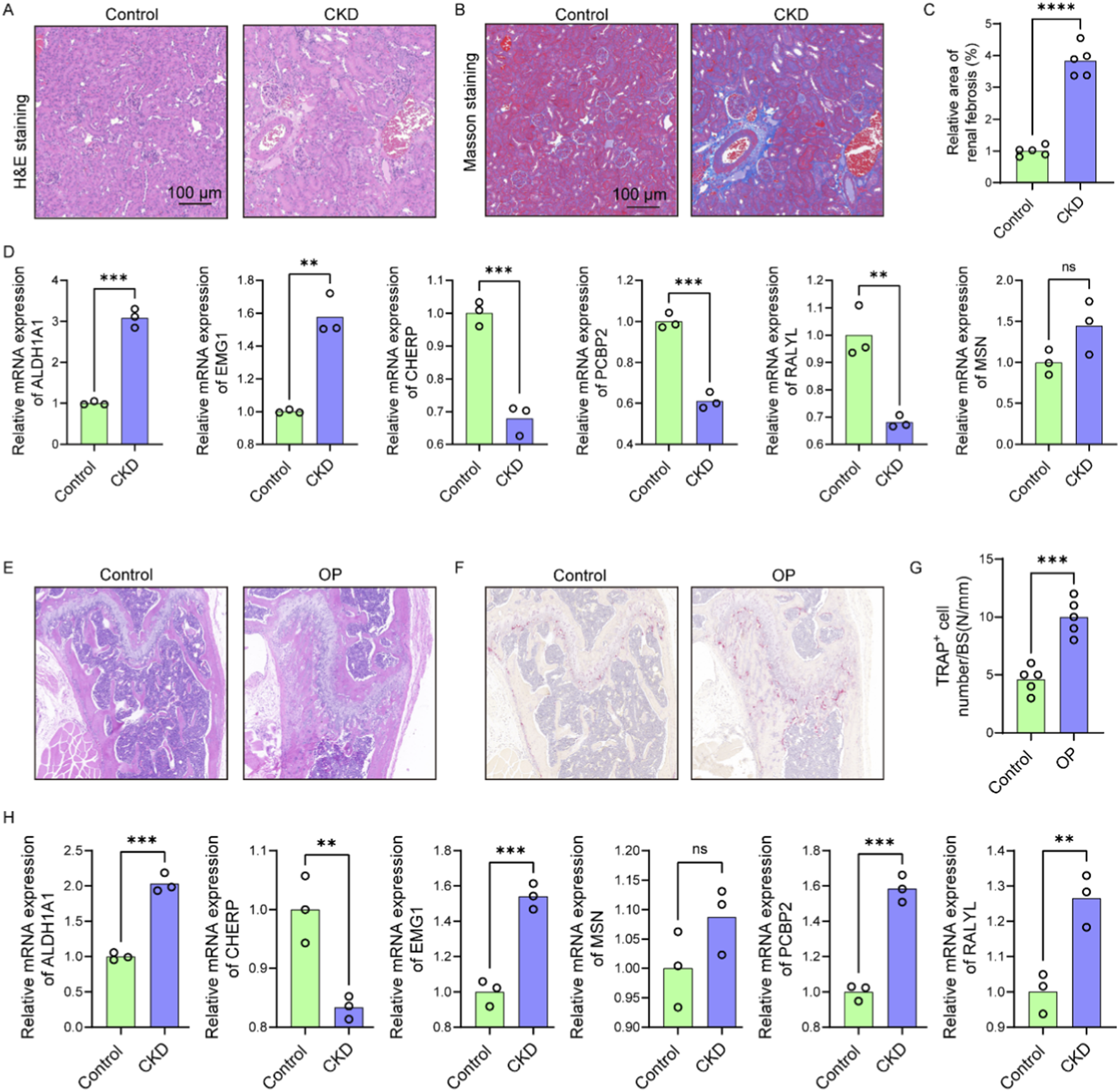 Histological images and bar graphs depicting experiments related to CKD and OP. Panels A and B show H&E and Masson staining of control and CKD samples. Panels E and F show similar staining for control and OP samples. Bar graphs (C, D, G, H) display relative mRNA expression data and cell numbers, with significant differences marked between control and experimental groups.