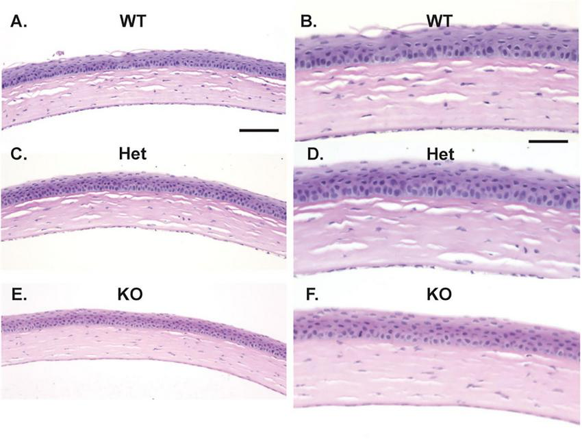Histological images of artery sections in three conditions: WT (A, B), Het (C, D), and KO (E, F). Panels A, C, E show the overall tissue structure, while B, D, F provide close-up views of the epithelial layers. WT sections display uniform cell layers; Het and KO show variations in cell density and structure. Each image features a scale bar for reference.