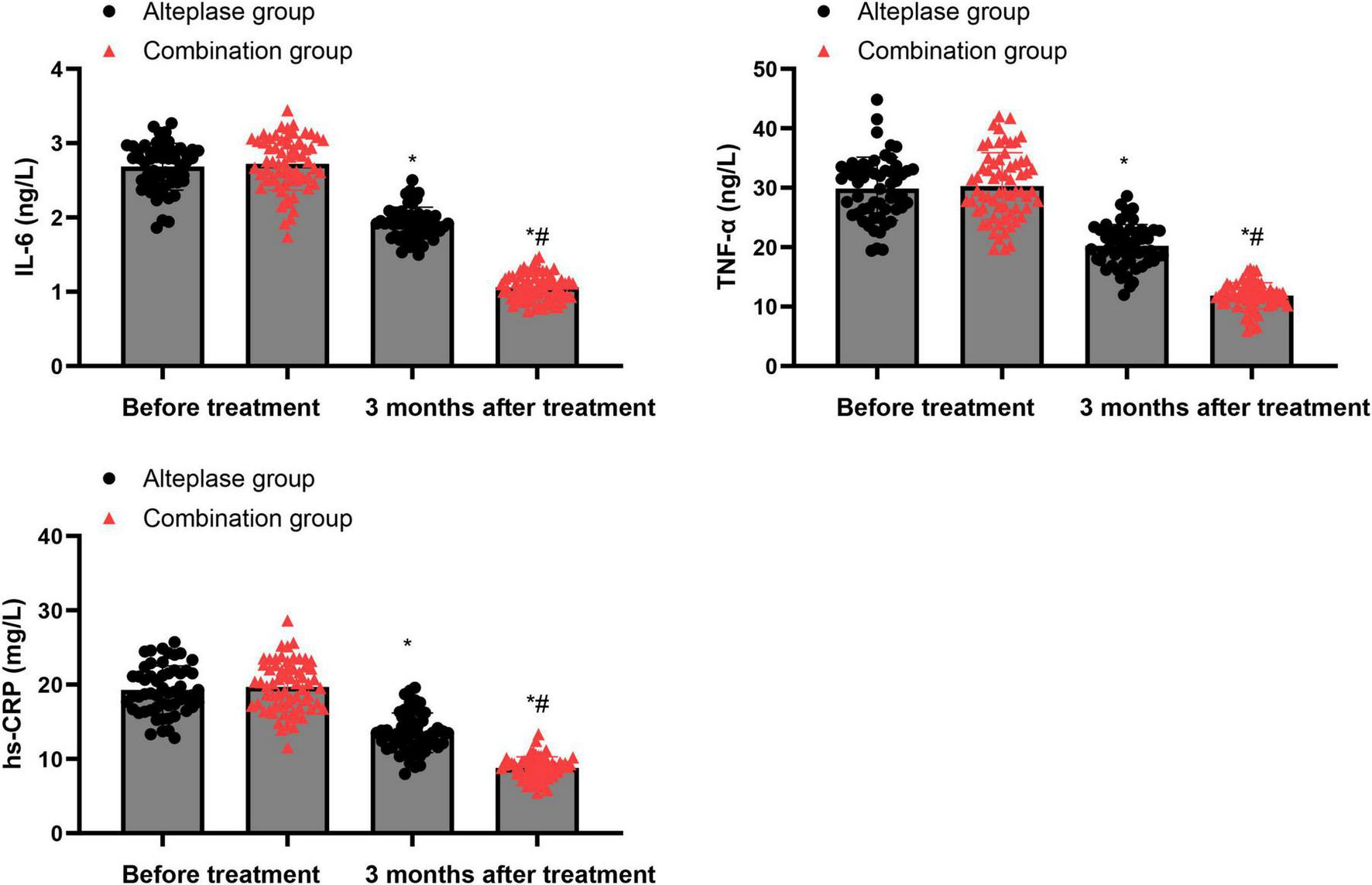 Bar graphs showing levels of IL-6, TNF-α, and hs-CRP before and three months after treatment for Alteplase and Combination groups. Black circles represent the Alteplase group, and red triangles represent the Combination group. Levels decrease significantly in both groups after treatment, with Combination group showing greater reduction.