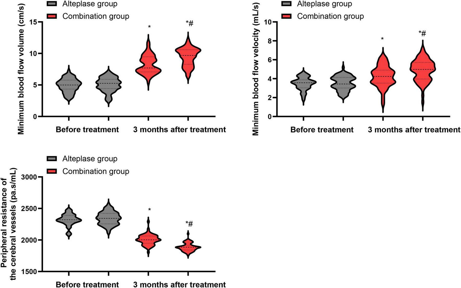 Three violin plots showing changes in blood flow metrics before and three months after treatment in Alteplase and Combination groups. The first plot depicts minimum blood flow volume, with the Combination group showing significant improvement. The second plot illustrates minimum blood flow velocity, again with notable gains in the Combination group after treatment. The third plot shows peripheral resistance of cerebral vessels, where the Combination group has a marked reduction post-treatment. Statistical significance is indicated by asterisks and symbols.
