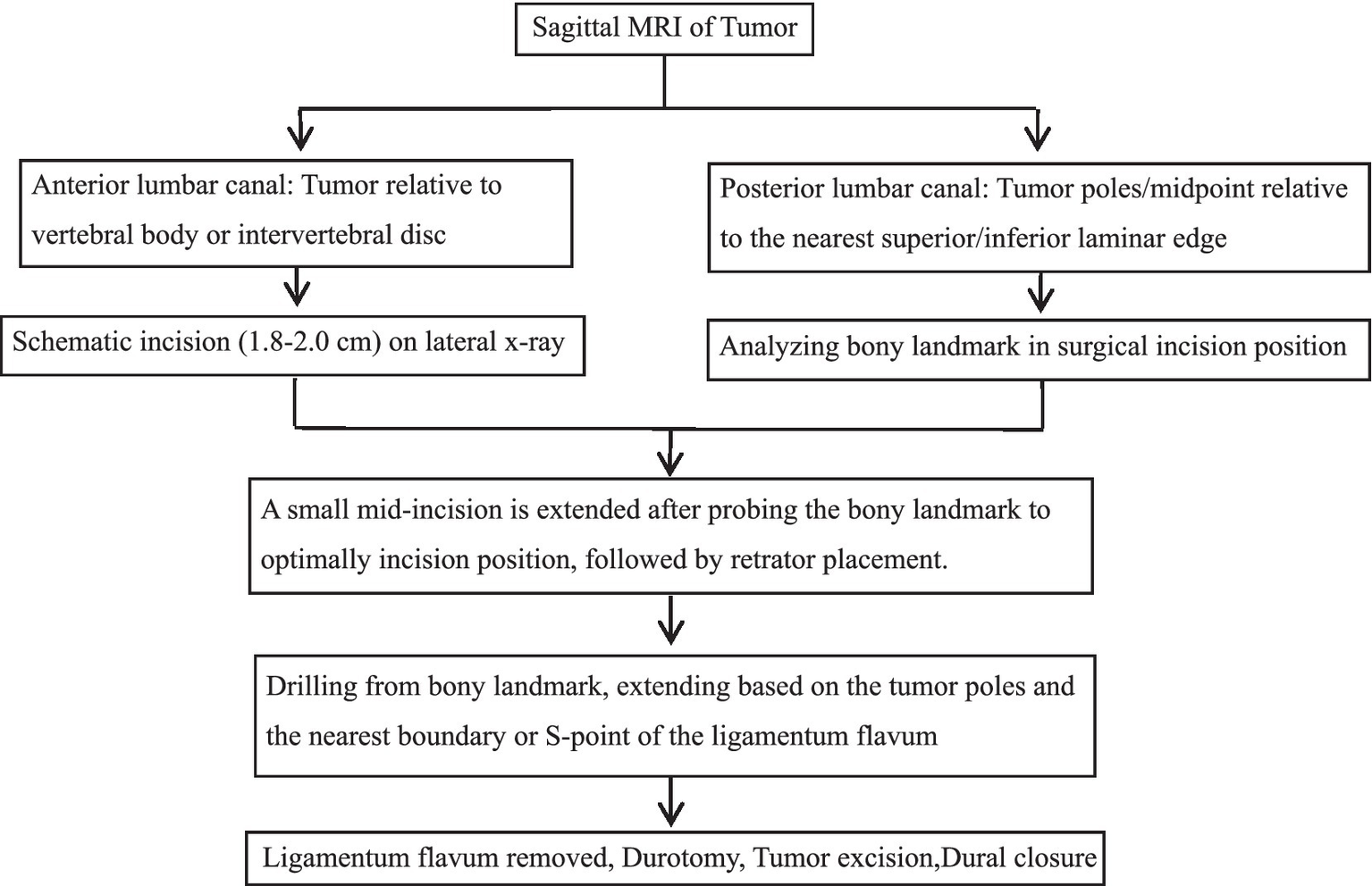 Surgical flowchart: Precision localization via laminar and ligamentum flavum boundaries for percutaneous minimally invasive resection of lumbar spinal schwannoma.