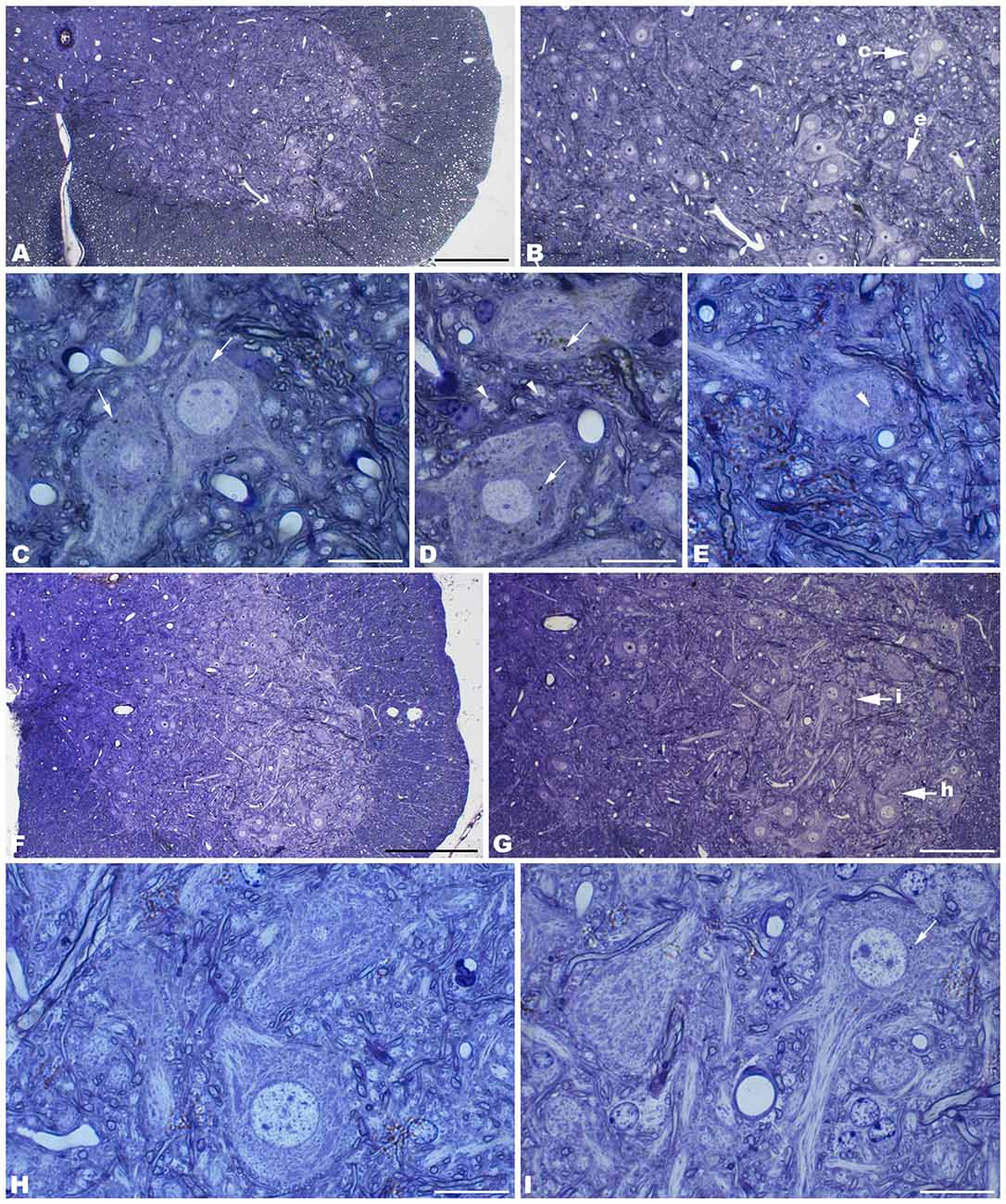 Frontiers | HERC 1 Ubiquitin Ligase Mutation Affects Neocortical, CA3 ...