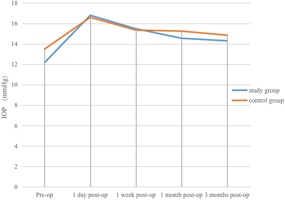 Line graph depicting intraocular pressure (IOP) in millimeters of mercury (mmHg) for study and control groups at pre-op, 1 day, 1 week, 1 month, and 3 months post-op. Both groups show a peak at 1 day post-op, followed by a decline and stabilization.