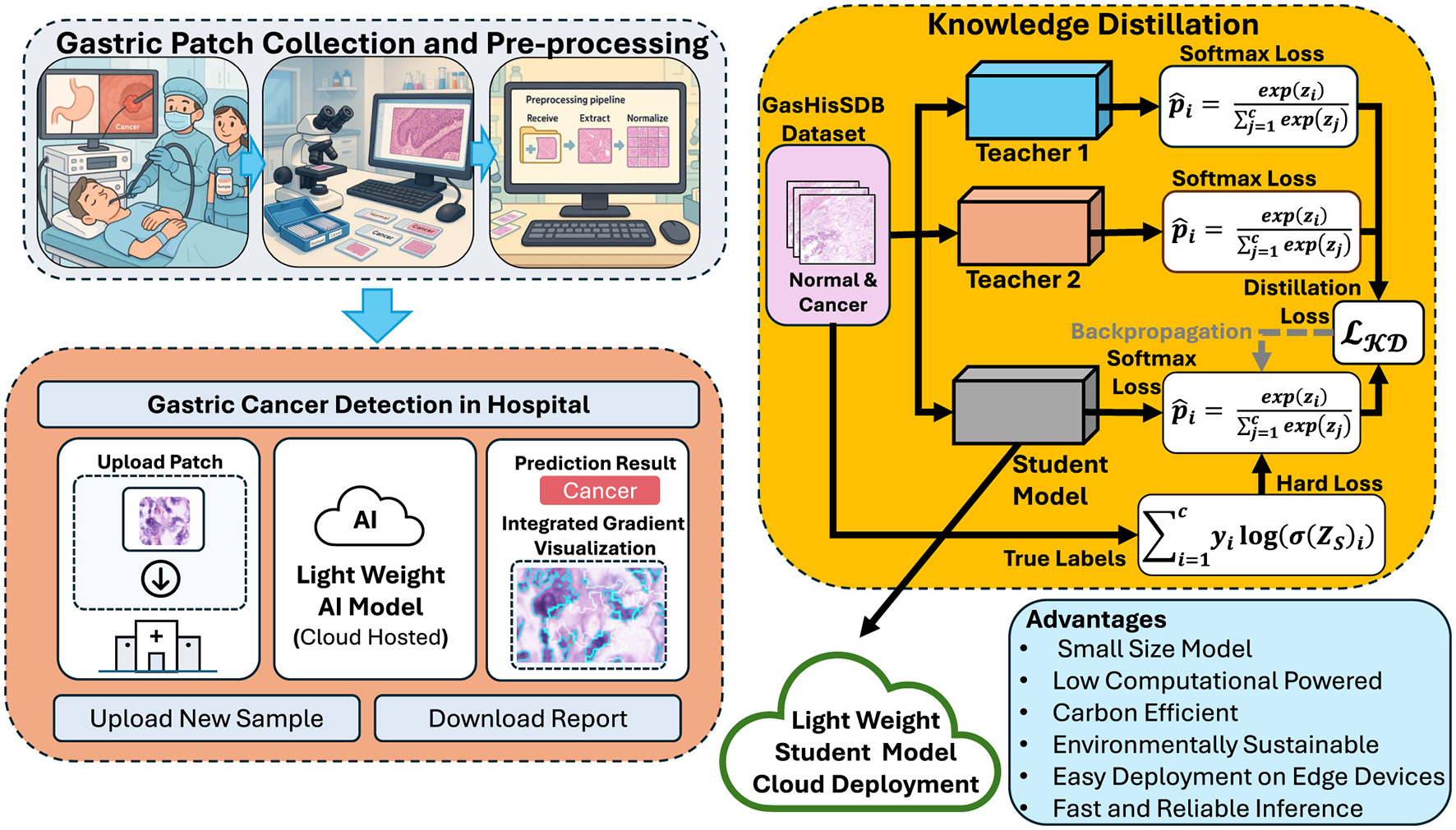 Illustration of a gastric cancer detection process. On the left, a diagram shows gastric patch collection and preprocessing using a hospital setting, lab equipment, and a computer. The center depicts a workflow with an AI model for cancer detection, including uploading patches and downloading reports. On the right, a knowledge distillation model uses datasets to train teacher and student models, with labels for various losses. Advantages listed include small model size, low computational needs, and sustainability. The process emphasizes cloud deployment and efficient diagnostics.