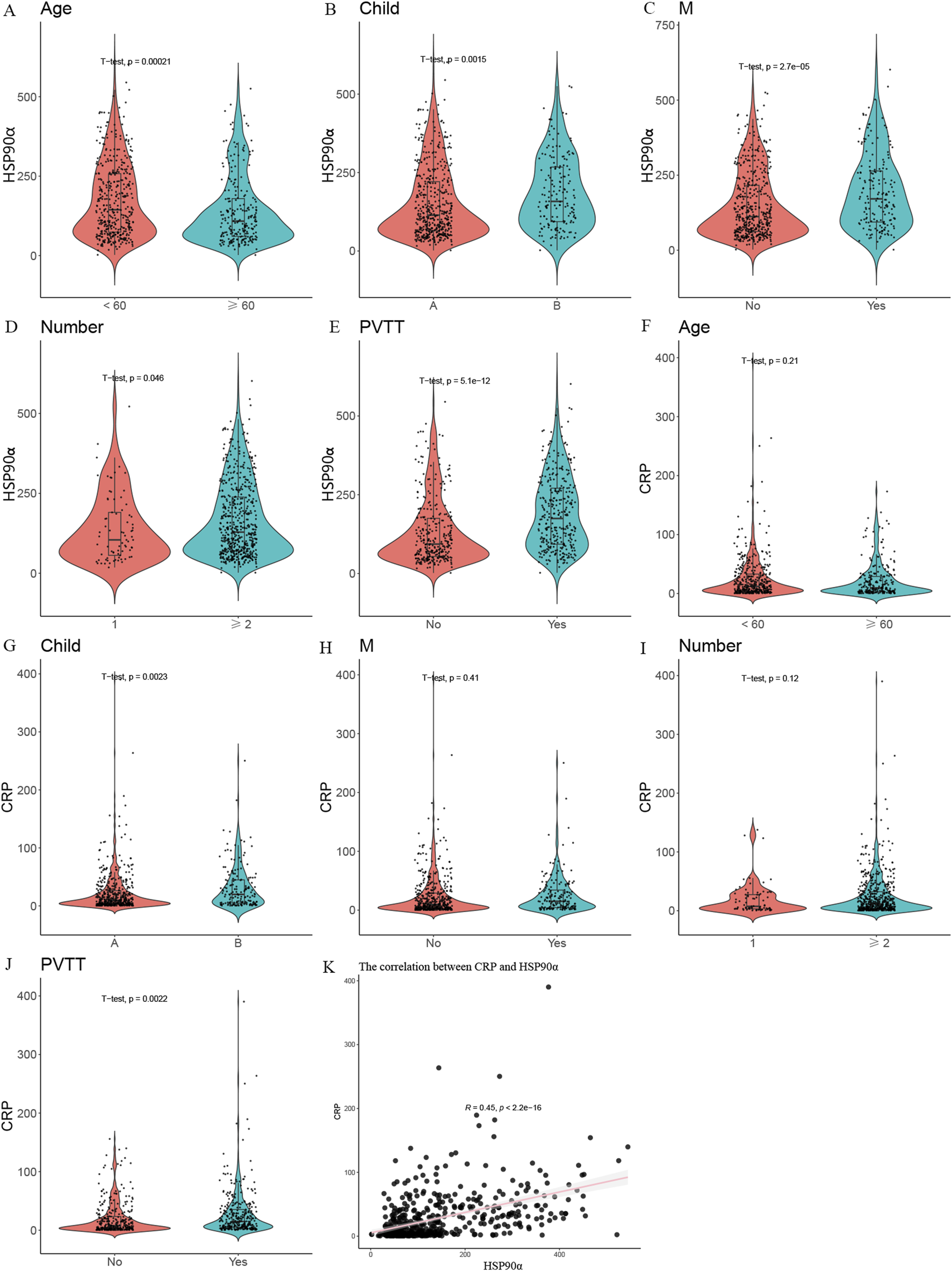 Violin plots and scatter plot comparing HSP90α and CRP levels across various factors. Plots A to E show HSP90α levels, while plots F to J show CRP levels. The factors include Age, Child status, M classification, Number, and PVTT status. Each plot includes T-test p-values. Plot K is a scatter plot showing a positive correlation between CRP and HSP90α, with a correlation coefficient of 0.45 and a significance level of p = 2.2e-16.