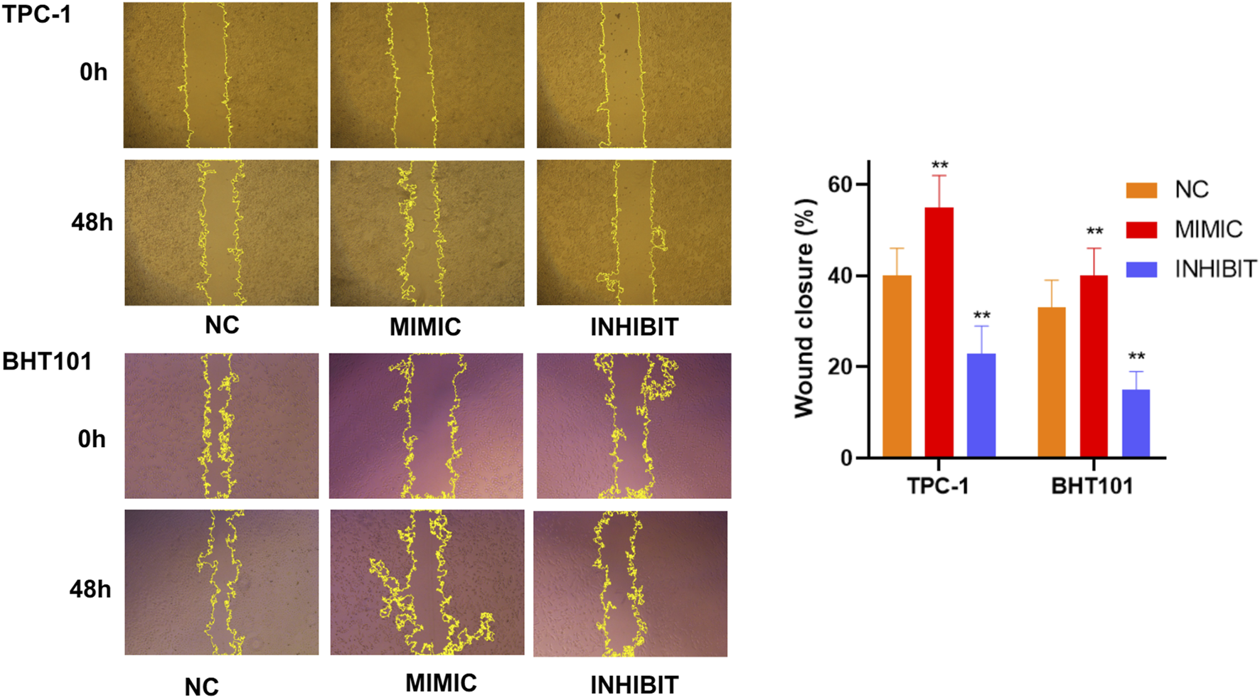 Cell migration assay images and bar graph show wound closure in TPC-1 and BHT101 cells over time. Top row: TPC-1 at 0 and 48 hours, with conditions NC, MIMIC, INHIBIT. Bottom row: BHT101 similarly arranged. Yellow lines indicate wound edges. Bar graph on the right displays wound closure percentages for NC (orange), MIMIC (red), and INHIBIT (blue), showing increased closure in MIMIC for both cell types. Stars indicate statistical significance.