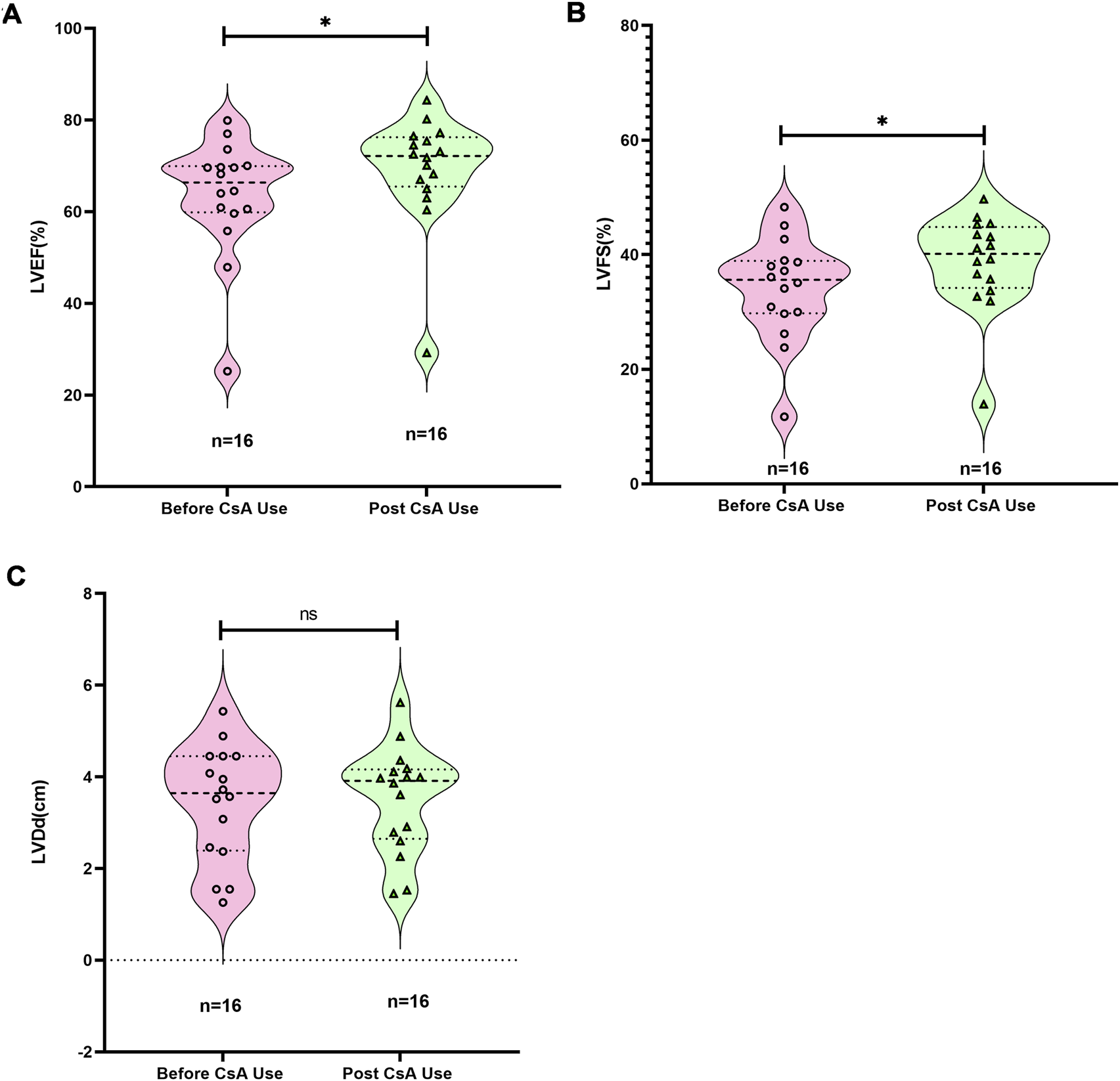 Violin plots displaying the effects of CsA use on heart function metrics: (A) shows LVEF improvement post-CsA, indicated by a significant increase; (B) illustrates increased LVFS post-CsA; (C) shows LVDd with no significant change. Each panel compares data before and after CsA use, with sample sizes of 16 for each group. Statistical significance is marked with an asterisk in panels A and B, and “ns” in C indicating no significance.