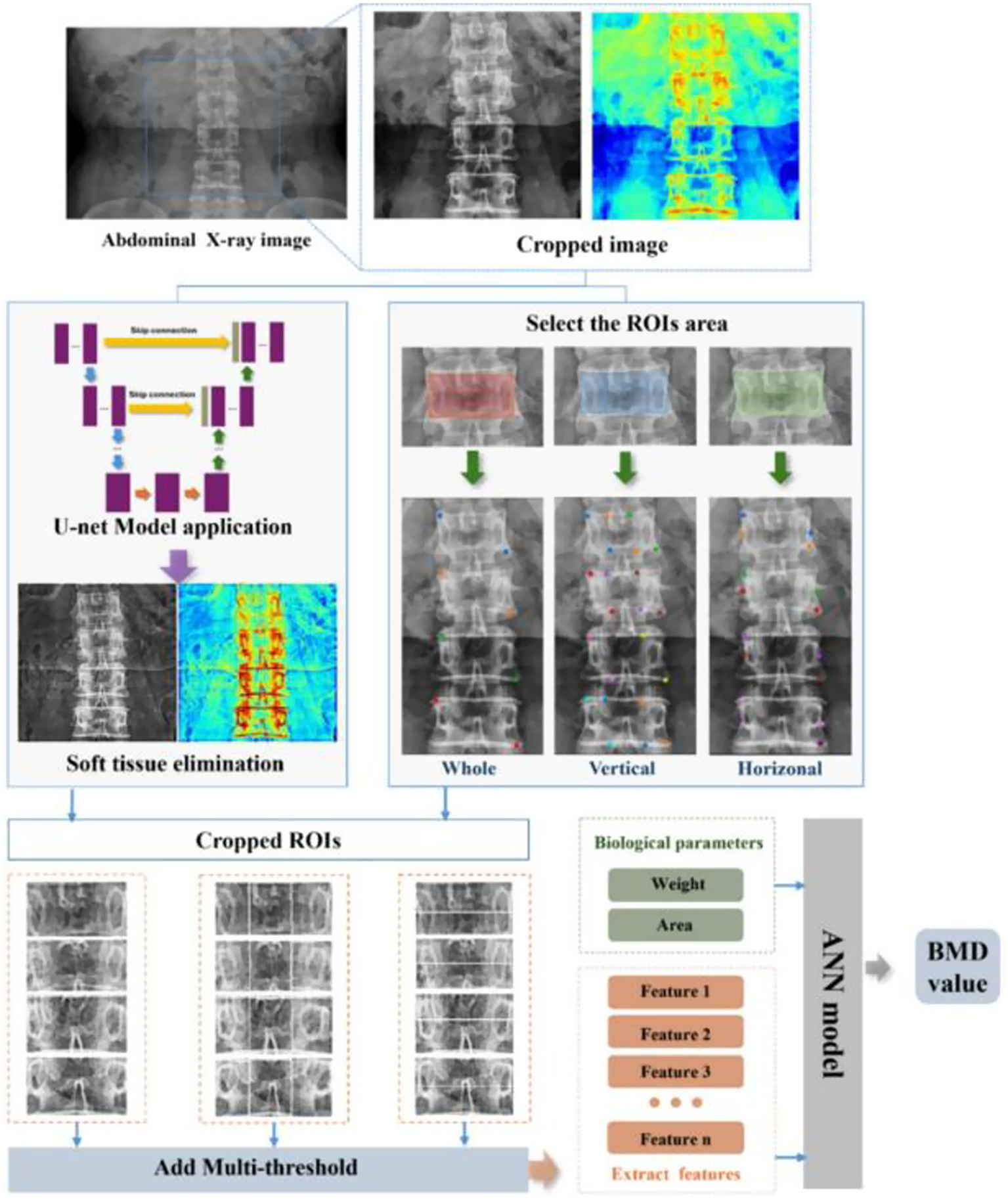 Flowchart showing a process for analyzing abdominal X-ray images. It starts with an X-ray and proceeds to a cropped image, followed by U-net model application for soft tissue elimination. Regions of interest (ROIs) are selected as whole, vertical, and horizontal areas. Cropped ROIs undergo multi-threshold addition. Biological parameters and extracted features are inputted into an ANN model to derive a BMD value.