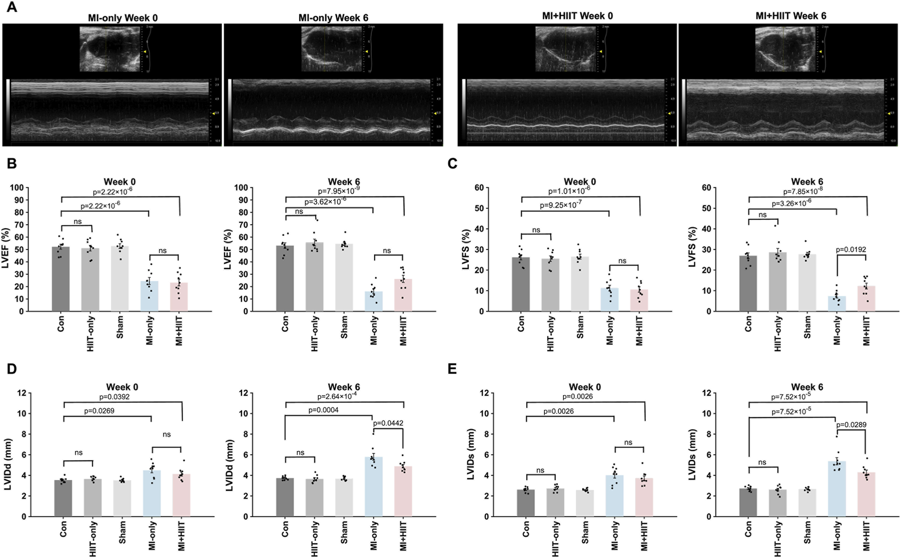 Graphs illustrate the effects of different conditions on cardiac function and structure over six weeks. Panel A displays ultrasound images. Panels B and C show changes in Left Ventricular Ejection Fraction (LVEF) and Fractional Shortening (LVFS). Panels D and E depict Left Ventricular Internal Dimension at Diastole (LVIDd) and Systole (LVIDs). Conditions include control (Con), high-intensity interval training (HIIT), Sham, myocardial infarction (MI)-only, and MI with HIIT. Significant differences and p-values are marked.