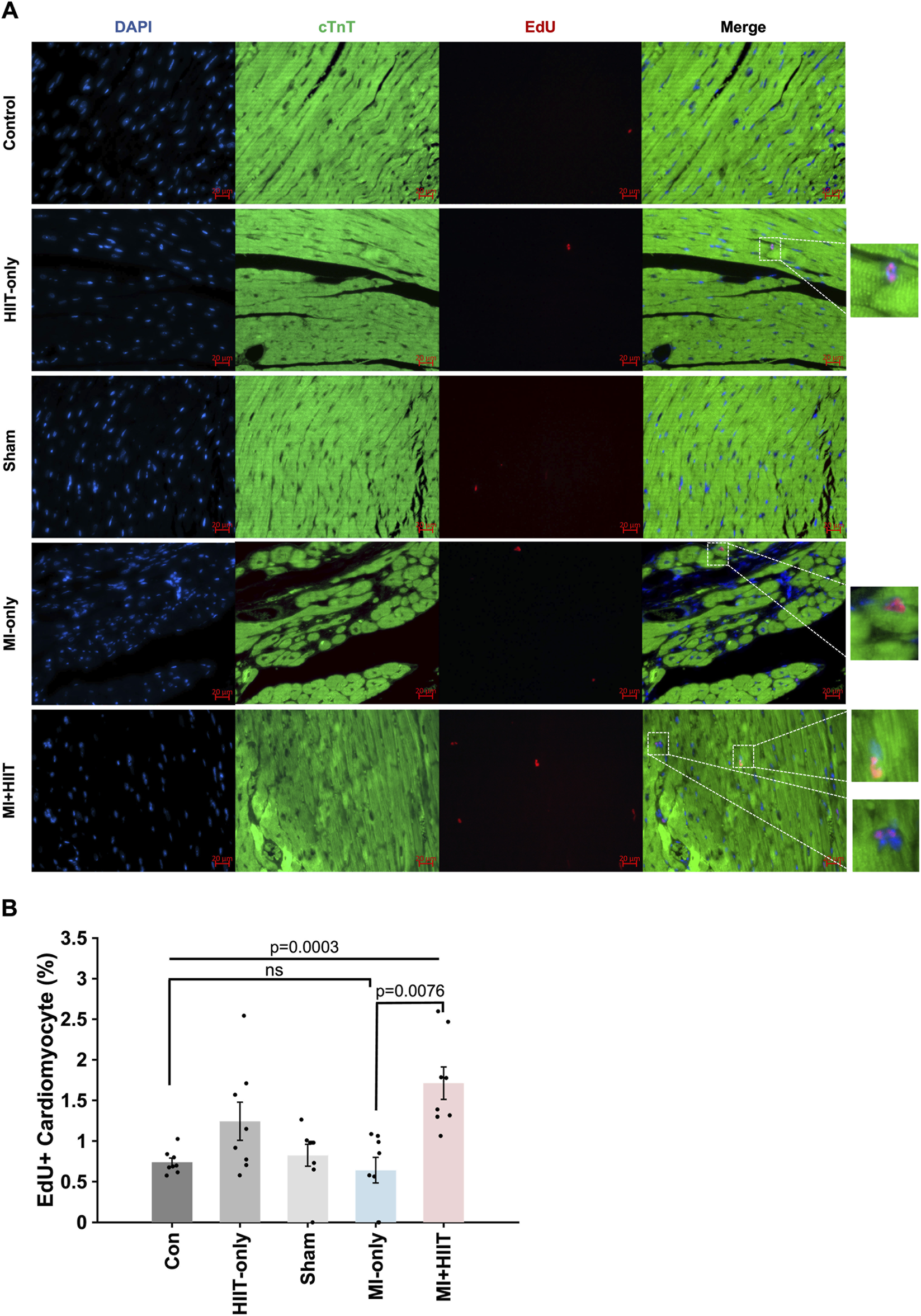Panel A shows fluorescence microscopy images of cardiac tissue from five experimental groups: Control, HIIT-only, Sham, MI-only, and MI+HIIT. Each group has four columns labeled DAPI, cTnT, EdU, and Merge, showing different staining methods. The MI+HIIT group displays notable EdU labeling. Panel B is a bar graph depicting the percentage of EdU-positive cardiomyocytes across the groups, highlighting significant increases in the MI+HIIT group with p-values indicated.