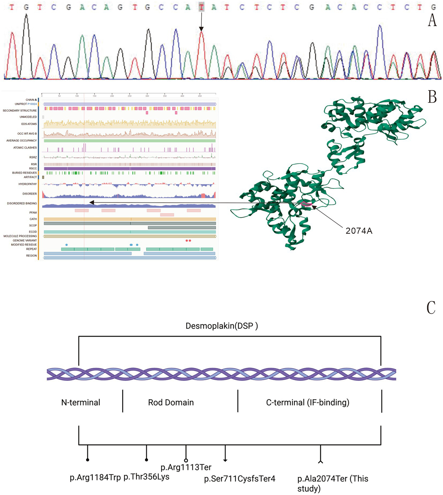 Panel A shows a DNA sequencing chromatogram with a highlighted mutation. Panel B displays a protein structure model for desmoplakin, with a mark at position 2074A, accompanied by graphs depicting different protein properties. Panel C illustrates a schematic of the desmoplakin protein, highlighting domains and related mutations, including the new finding at p.Ala2074Ter.