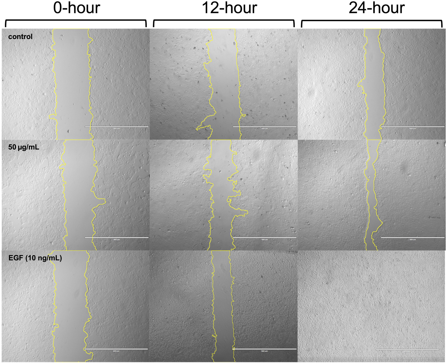 Three rows of wound healing assays are shown at 0, 12, and 24-hour intervals. The top row is the control, the middle row is treated with 50 micrograms per milliliter, and the bottom row with EGF at 10 nanograms per milliliter. Yellow lines outline the wound areas, showing reduction over time, indicating cell migration.