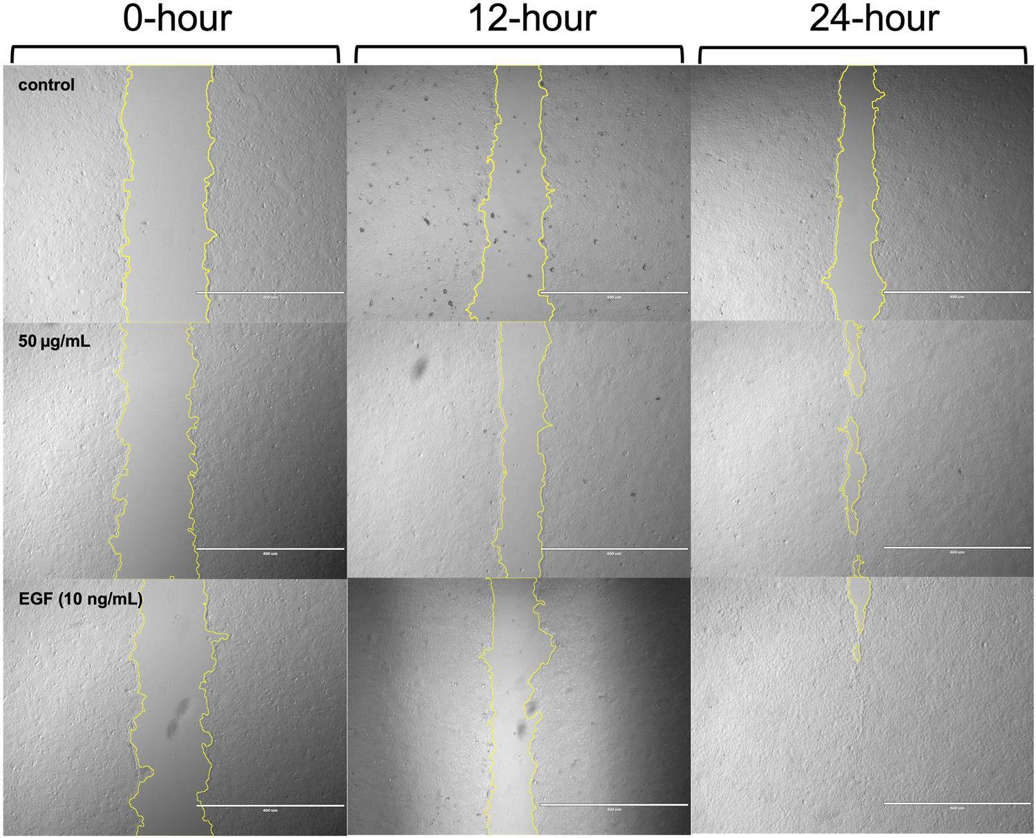 Comparison of cell migration over time in a scratch assay with three conditions: control, 50 micrograms per milliliter, and epidermal growth factor (EGF) at 10 nanograms per milliliter. Images are taken at 0, 12, and 24 hours. Yellow outlines indicate wound edges. Cell migration closes gaps more in EGF-treated samples over time.