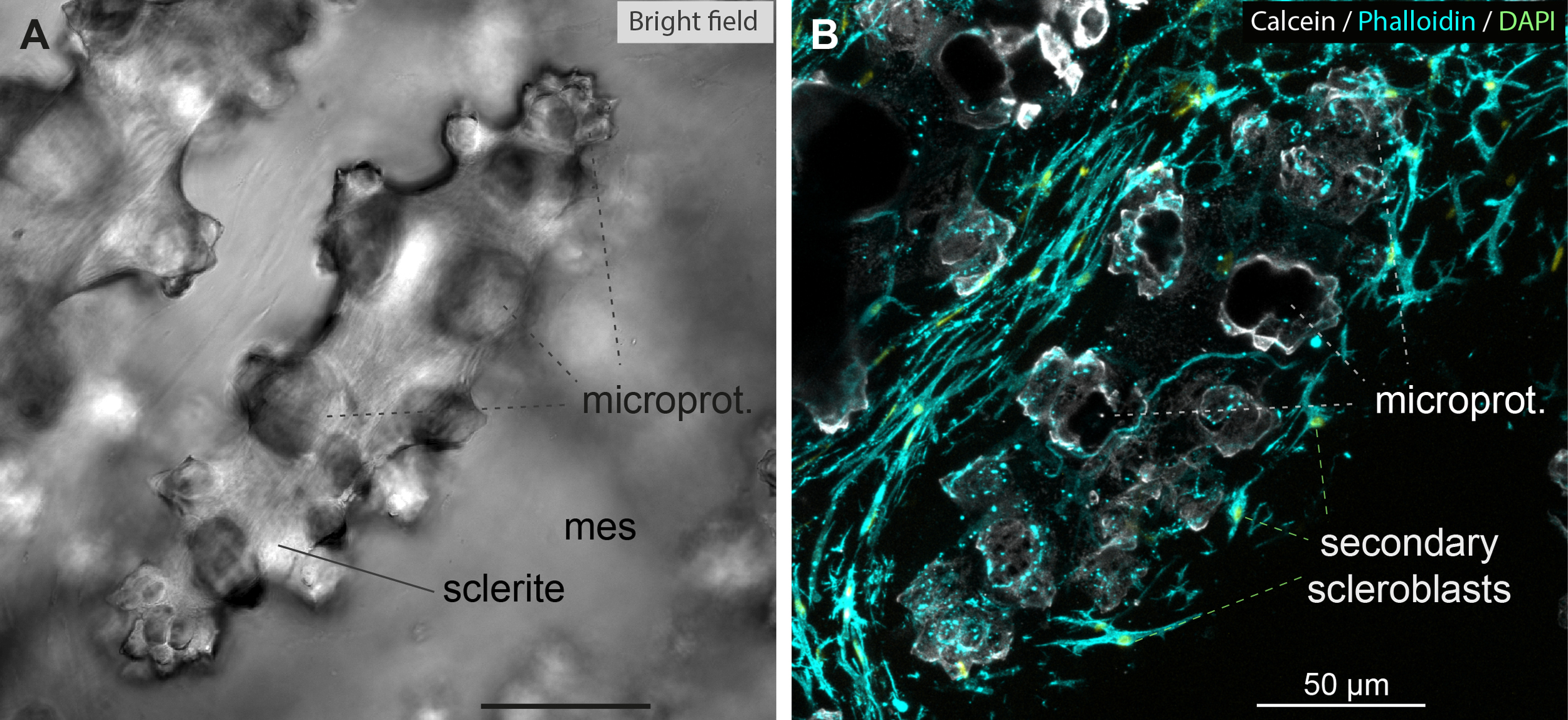 (A) Bright-field image of a sclerite with its microprotuberances embedded in the mesoglea. (B) Fluorescence image showing calcein-, phalloidin-, and DAPI-stained structures, highlighting a sclerite with microprotuberances within the secondary scleroblastic network. Scale bar: 50 µm.