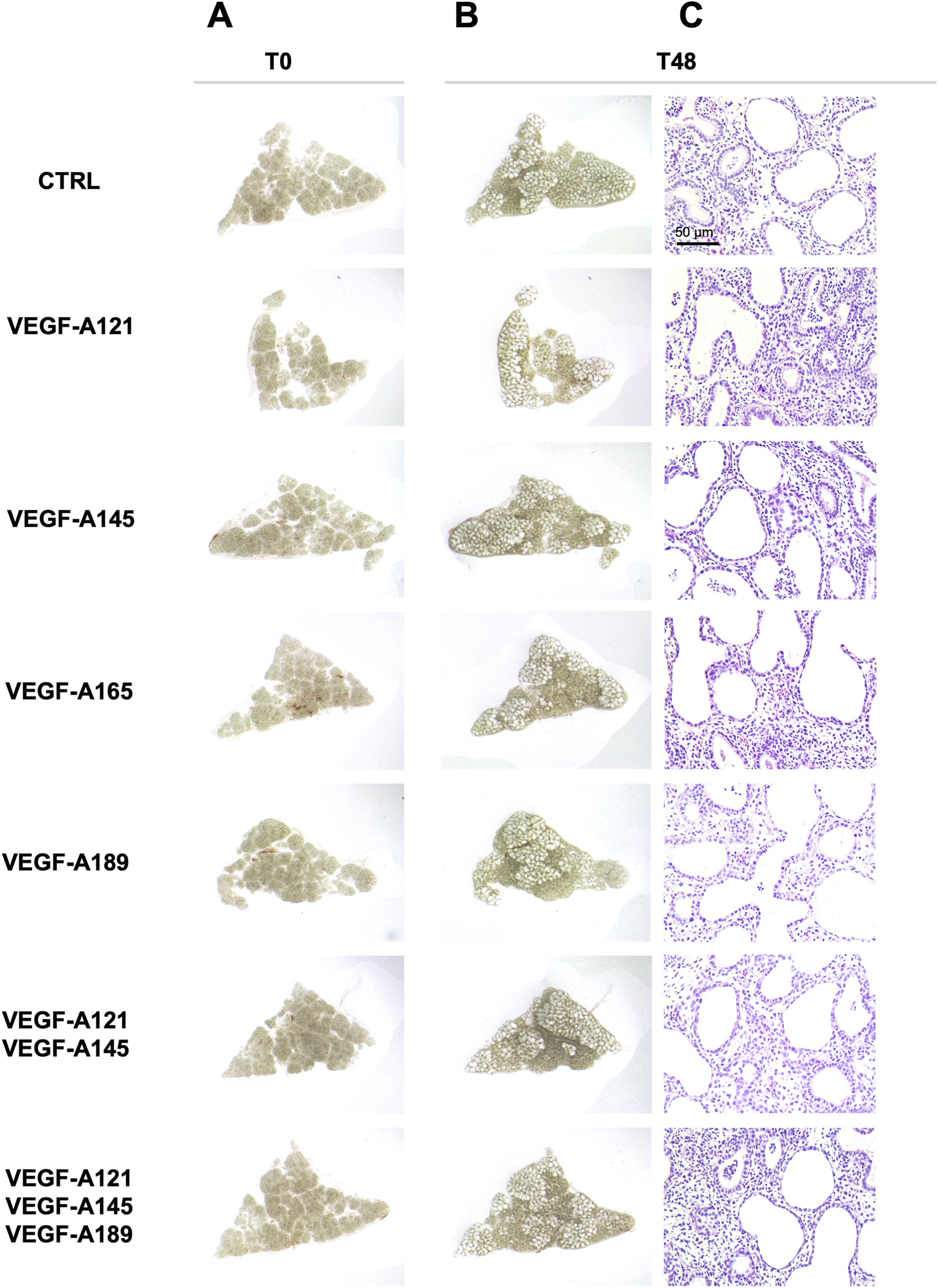 Microscopic images of tissue samples are presented in three columns labeled A, B, and C, corresponding to time points T0 and T48. Rows are labeled CTRL, VEGF-A121, VEGF-A145, VEGF-A165, VEGF-A189, and combinations of these. Column A (T0) shows initial tissue states; column B shows modified states; column C (T48) displays structures at higher magnification, with a 50 micrometer scale bar, showing varying cellular patterns across conditions.
