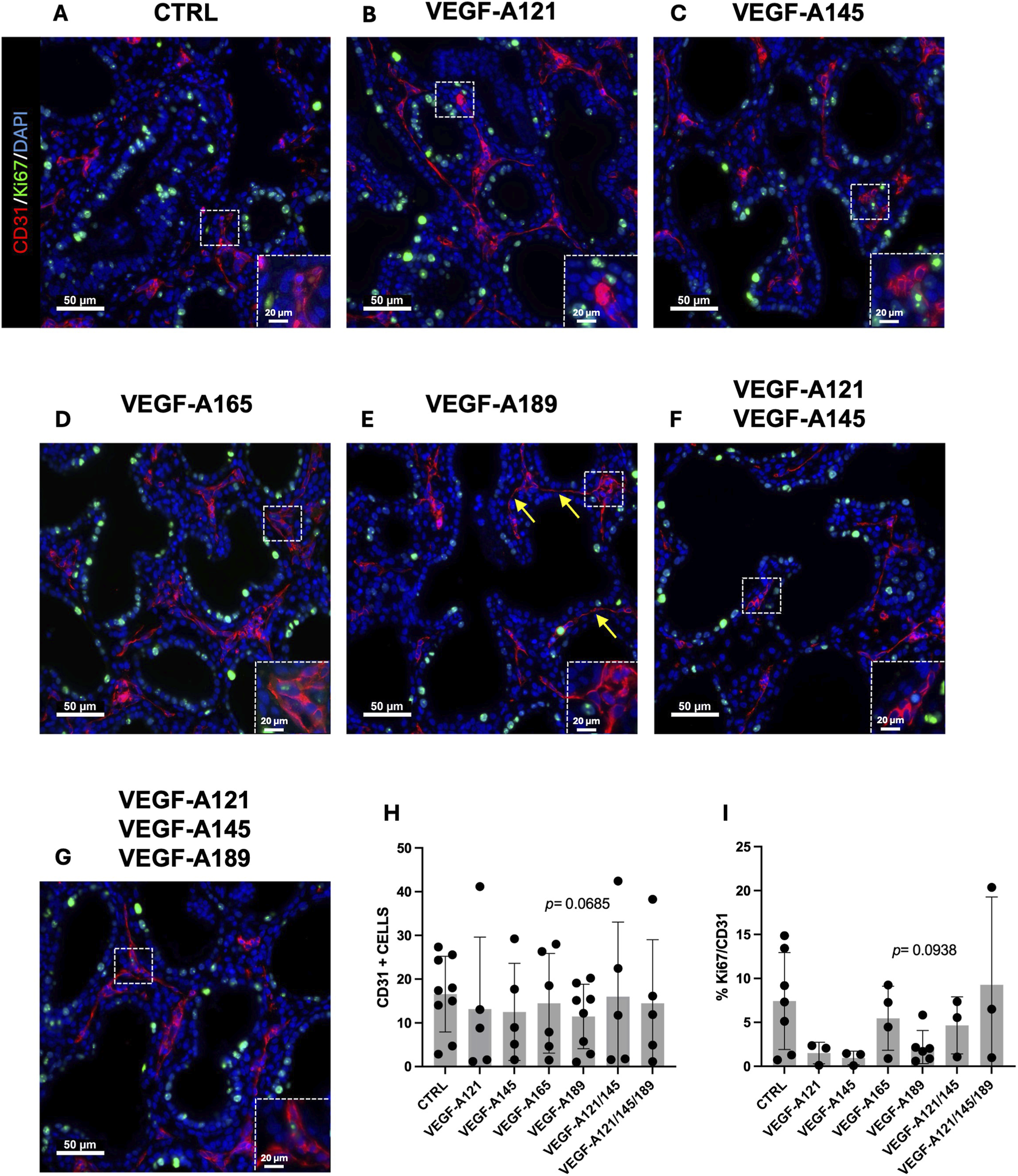 Fluorescent microscopy images A-G show tissue samples with CD31 in red, Ki67 in green, and nuclei in blue under different conditions (CTRL, VEGF isoforms). Insets at 20 μm magnification highlight specific regions. Yellow arrows in E indicate specific features. Graphs H and I present quantified CD31 positive cells and percentage of Ki67/CD31, respectively, across different VEGF treatments, with statistical significance denoted.