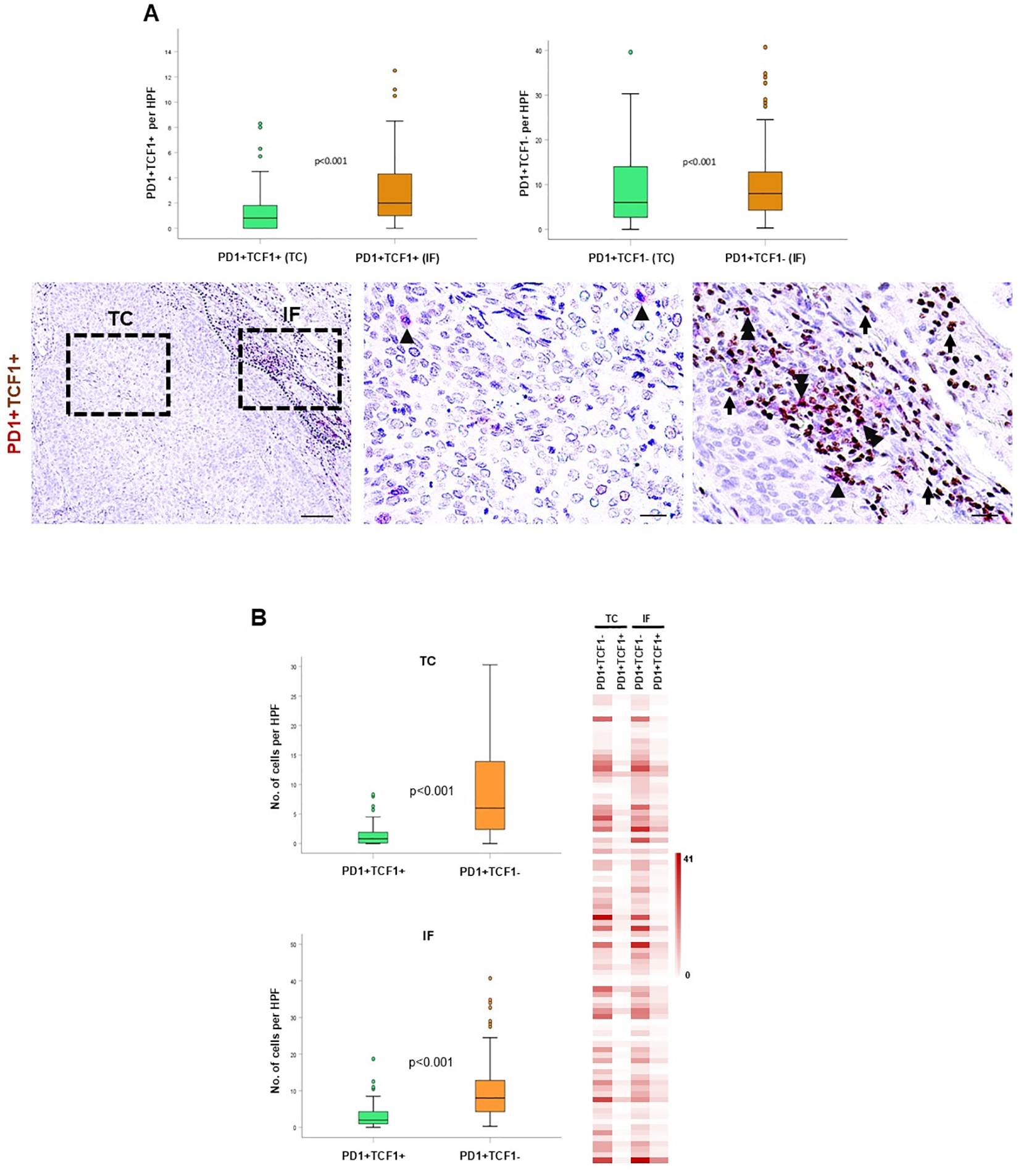 Two panels detailing data and images. Panel A includes three box plots comparing PD1+TCF1+ and PD1+TCF1- expression in TC and IF conditions, with p-values. Below, three microscope images show tissue labeled with PD1+TCF1+. Panel B features two additional box plots representing the number of cells per HPF for TC and IF conditions, along with a heat map showing expression levels under different conditions.