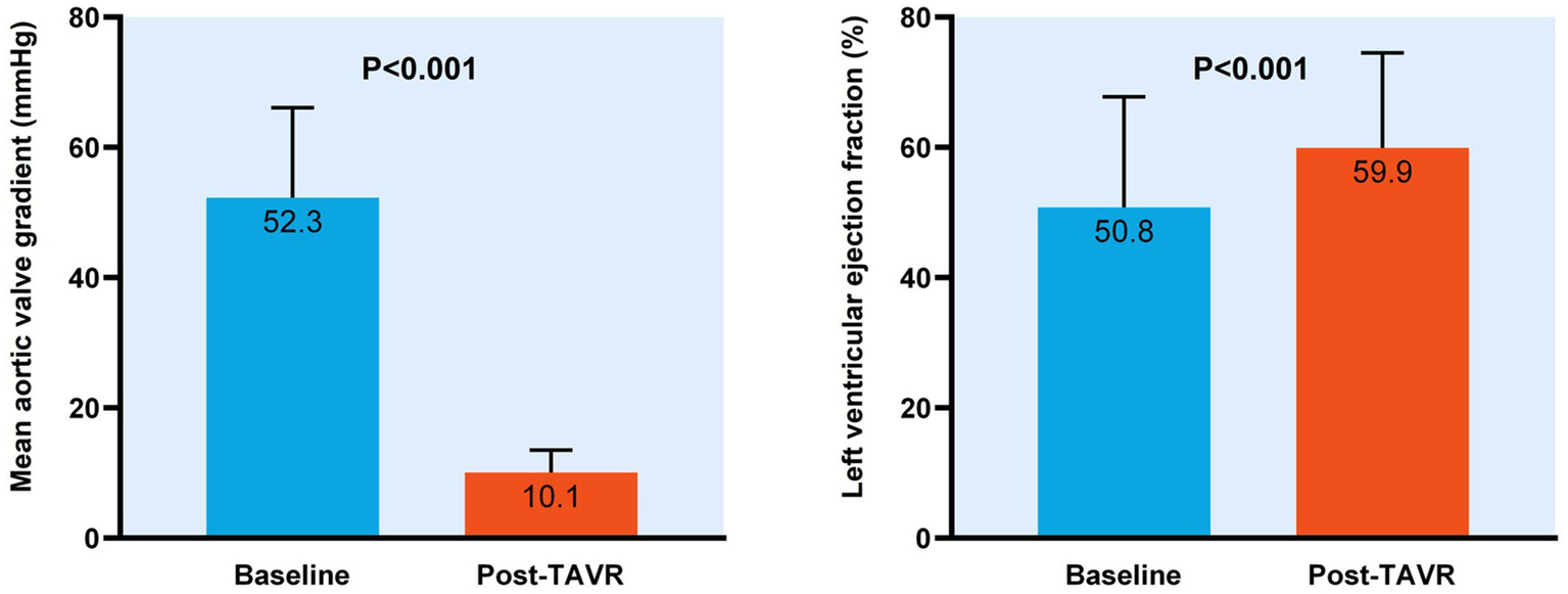 Two bar graphs show changes from baseline to post-TAVR. The left graph depicts a decrease in mean aortic valve gradient from 52.3 mmHg to 10.1 mmHg. The right graph shows an increase in left ventricular ejection fraction from 50.8% to 59.9%. Both graphs have significance values of P<0.001.