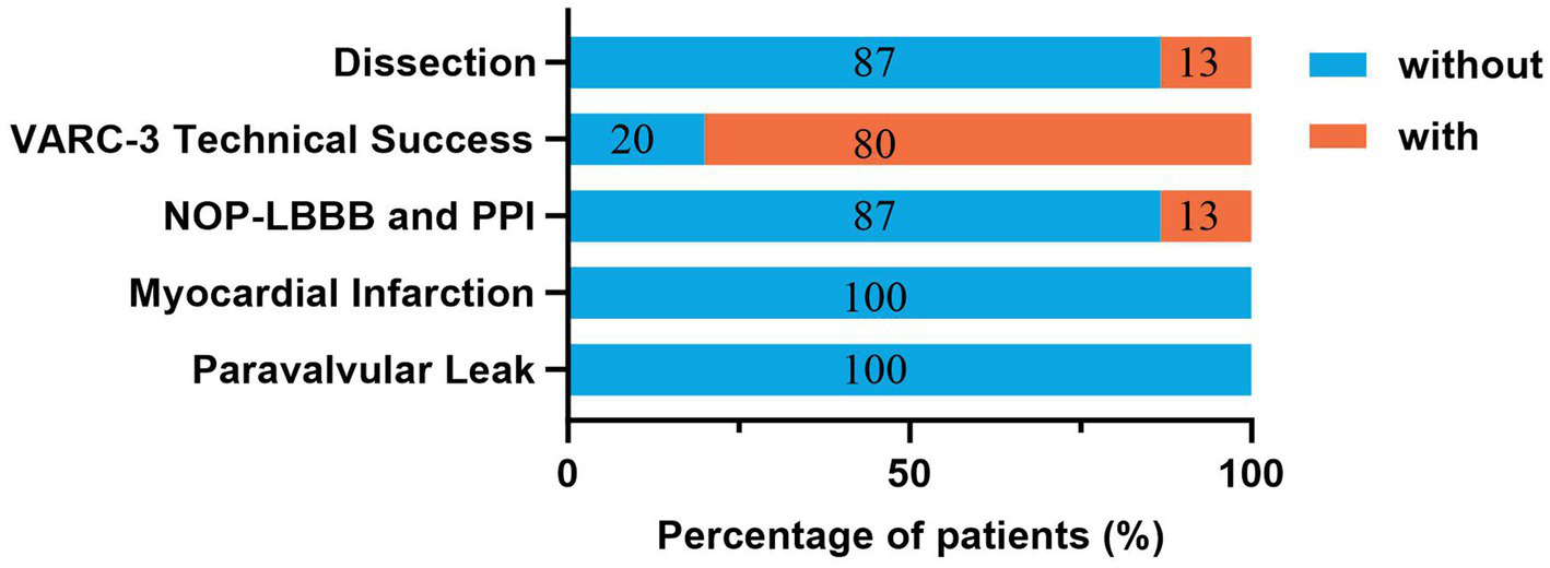 Bar chart showing percentages of patients with and without complications. Dissection: 87% without, 13% with. VARC-3 Technical Success: 20% without, 80% with. NOP-LBBB and PPI: 87% without, 13% with. Myocardial Infarction and Paravalvular Leak: both 100% without complications.