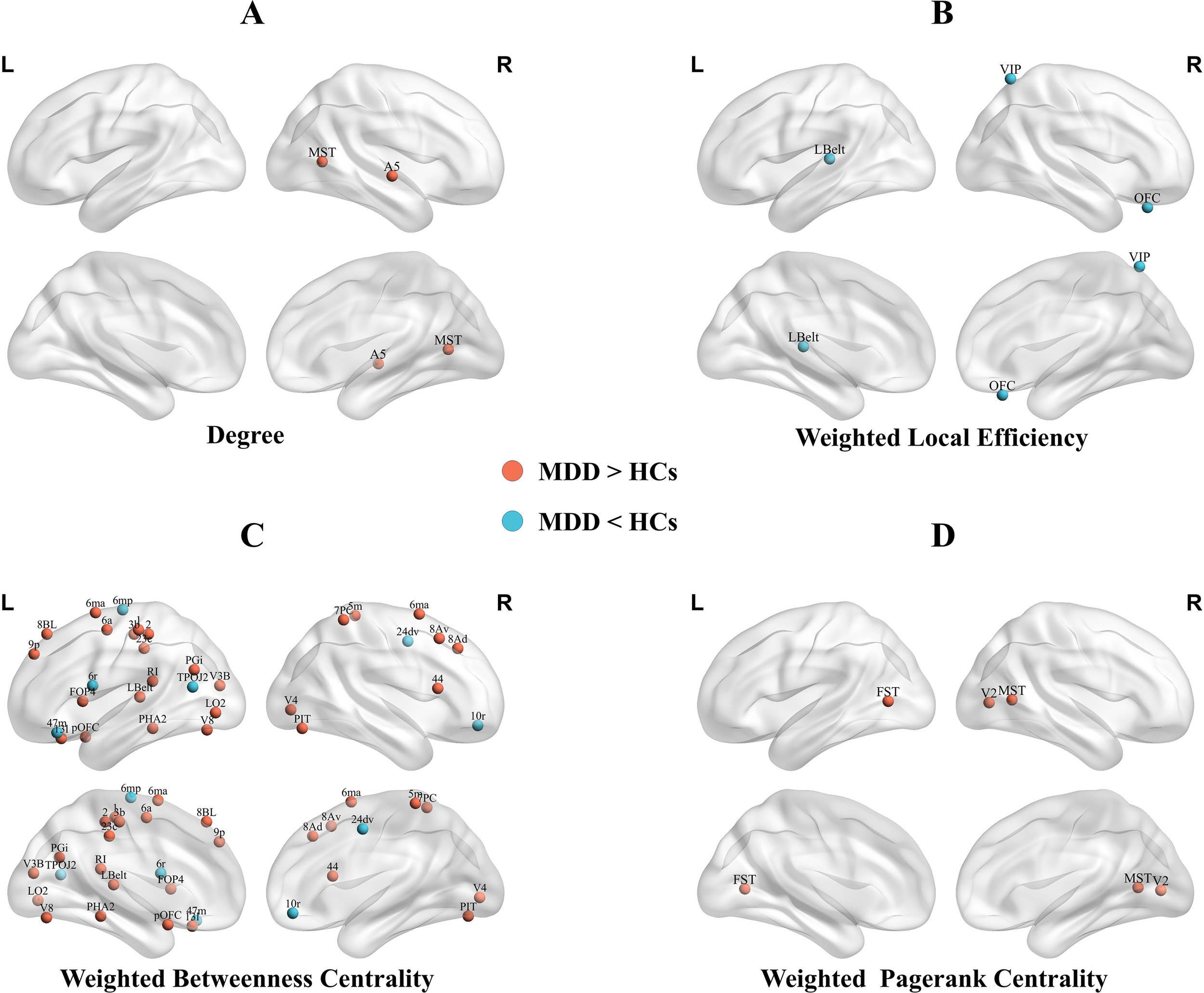 Brain diagrams labeled A, B, C, and D show different network metrics: Degree (A), Weighted Local Efficiency (B), Weighted Betweenness Centrality (C), and Weighted Pagerank Centrality (D). Red dots indicate areas where metrics are higher in Major Depressive Disorder (MDD) patients compared to Healthy Controls (HCs), while blue dots indicate the opposite. Each diagram has various brain regions marked with labels such as MST, OFC, VIP, and others.