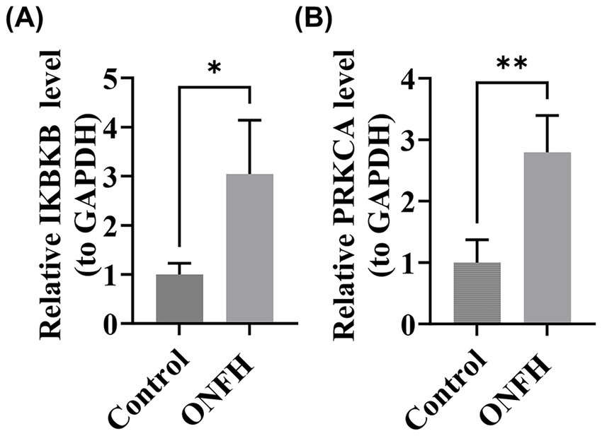 Bar graphs comparing relative levels of IKBKB and PRKCA to GAPDH in control and ONFH groups. Graph (A) shows IKBKB levels, significantly higher in ONFH. Graph (B) shows PRKCA levels, also significantly higher in ONFH. Asterisk indicates statistical significance.