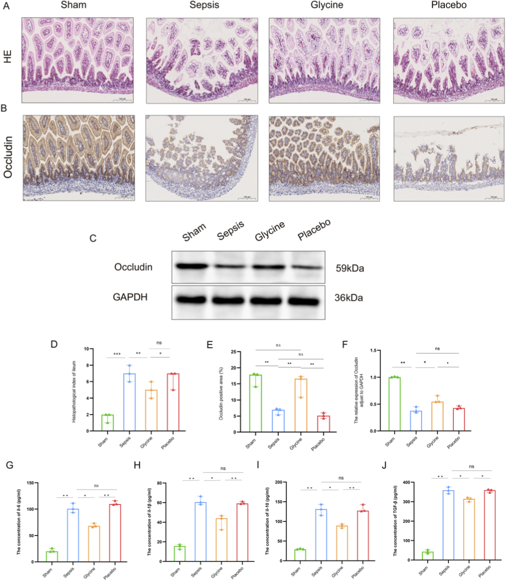 Histological and biochemical analysis of intestinal tissues. Panels A and B show histological sections stained with Hematoxylin and Eosin (HE) and immunohistochemical staining for occludin, respectively, across sham, sepsis, glycine, and placebo groups. Panel C presents Western blot results for occludin and GAPDH. Panels D-J display bar graphs comparing various measurements, including histopathological scores, occludin protein levels, and cytokine concentrations (IL-6, IL-1β, IL-10, TNF-α) across the groups, with statistical significance indicated.