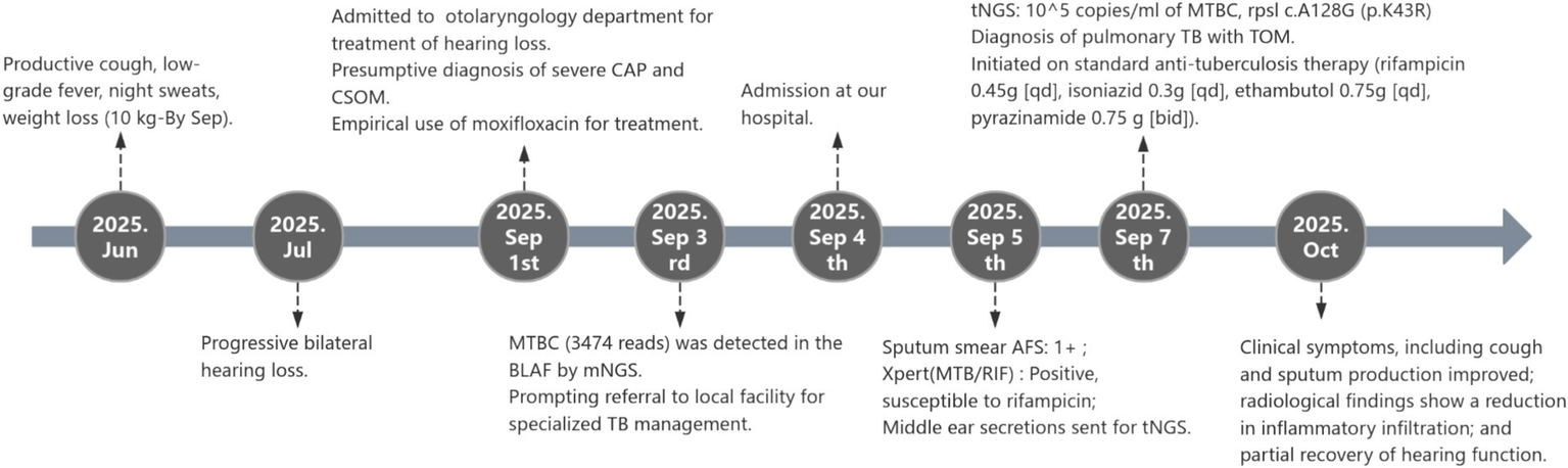 Timeline of a medical case in 2025 showing gradual progression and treatment of symptoms. June: Cough, fever, weight loss. July: Hearing loss. September 1: Diagnosis of severe CAP and CSOM, moxifloxacin treatment. September 3: MTBC detected, referral for TB management. September 4: Hospital admission. September 5: Positive Xpert test, rifampicin-susceptible. September 7: TB treatment initiated. October: Symptoms and radiology improved, partial hearing recovery.
