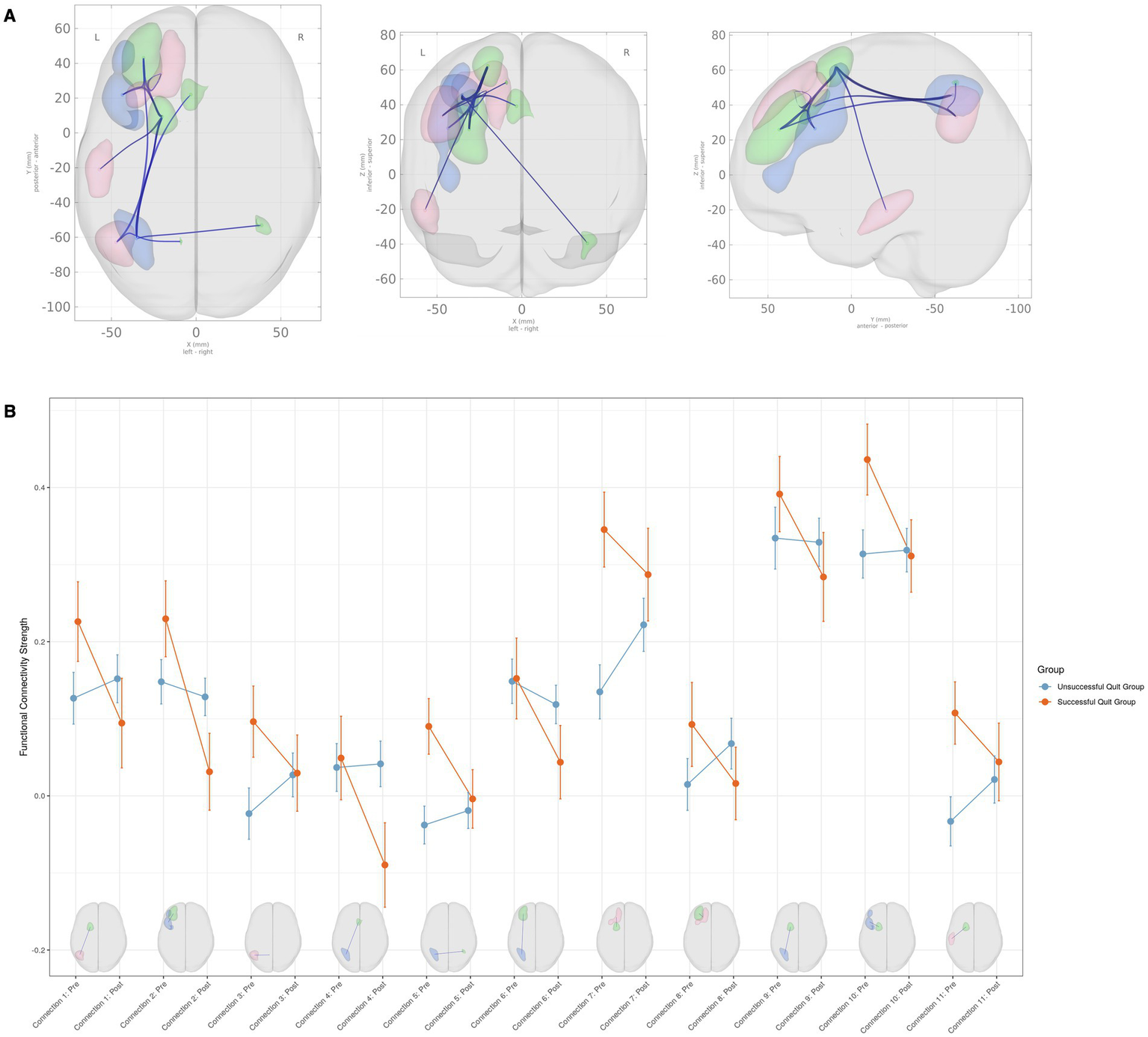 Panel A shows brain maps with colored regions and blue lines indicating connectivity across three different views. Panel B presents a graph of functional connectivity strength across conditions, with orange and blue lines and dots representing two groups: Successful and Unsuccessful Out Group. Each condition is linked to brain images shown below the graph.