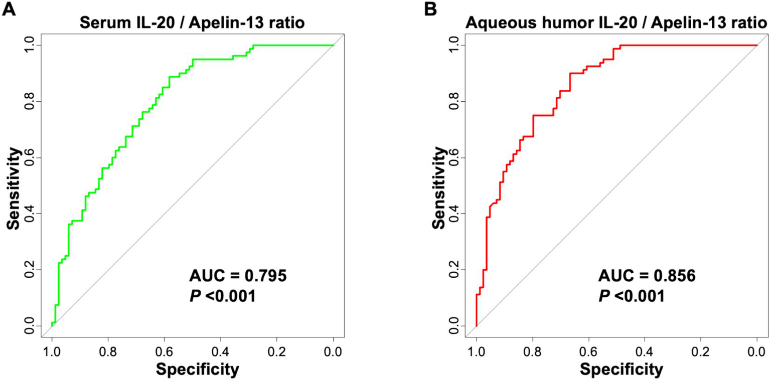 Two Receiver Operating Characteristic (ROC) curves compare the sensitivity and specificity of the IL-20 to Apelin-13 ratio in serum (green) and aqueous humor (red). Plot A shows serum with an Area Under the Curve (AUC) of 0.795 and Plot B shows aqueous humor with an AUC of 0.856. Both results have a statistical significance of P<0.001.