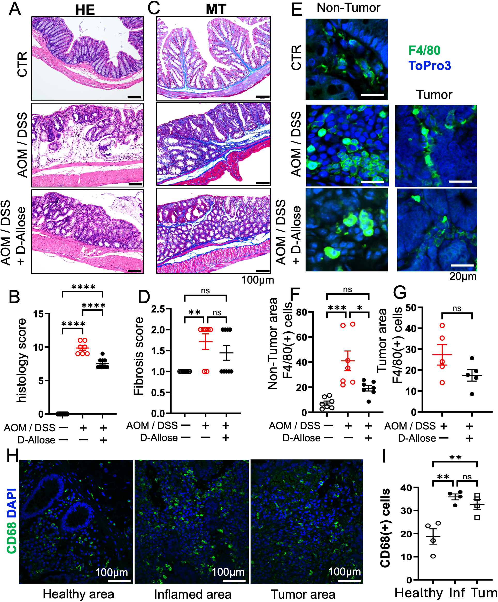 Panel A and C show histological images of colon tissue stained with hematoxylin and eosin (HE) and Masson's trichrome (MT), respectively, comparing control (CTR), AOM/DSS treatment, and AOM/DSS with D-Allose supplementation. Panel B and D are scatter plots quantifying histology and fibrosis scores. Panel E displays immunofluorescence images of F4/80-positive cells (green) in non-tumor and tumor areas, with DAPI (blue) counterstaining, and panel F and G present scatter plots quantifying F4/80-positive cells in non-tumor and tumor areas. Panel H shows fluorescence microscopy of CD68-positive cells (green) in healthy, inflamed, and tumor colon areas with DAPI (blue), and panel I is a scatter plot quantifying CD68-positive cells per group. Statistical significance is indicated on plots. Scale bars are present in all image panels.