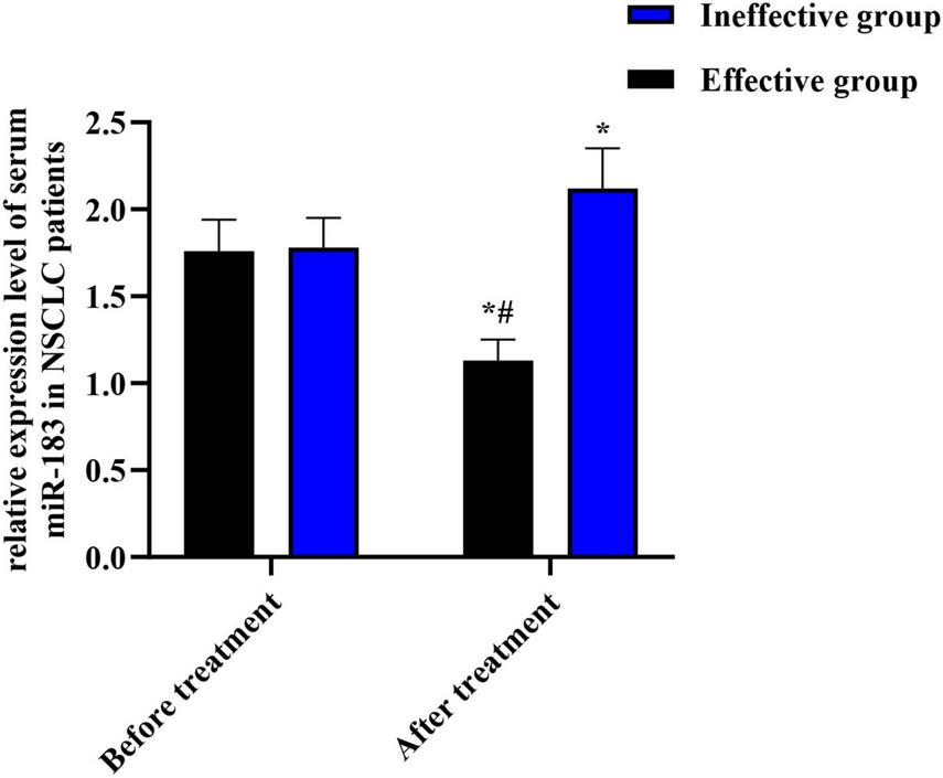 Bar graph showing the relative expression levels of serum miRNA-183 in NSCLC patients before and after treatment. The effective group (black) and ineffective group (blue) are compared. Before treatment, both groups show similar expression levels. After treatment, the ineffective group’s level increases significantly, while the effective group’s level decreases. Asterisks indicate statistical significance.