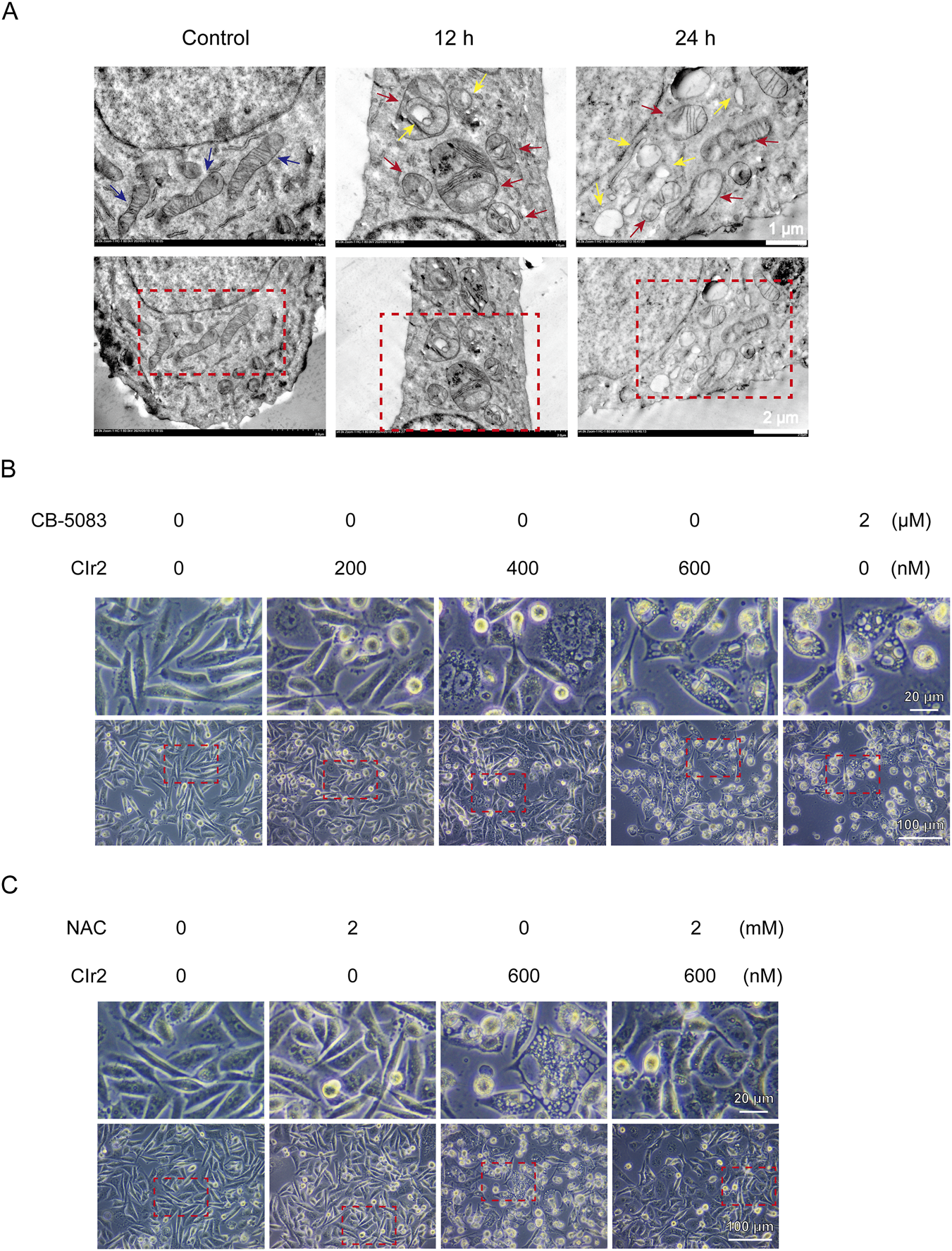 Panel A shows electron microscopy images at different time points: Control, twelve hours, and twenty-four hours, highlighting cellular structures with colored arrows and dashed rectangles. Panel B presents cell culture images under varying concentrations of CB-5083 and Clr2, with annotations on specific areas. Panel C displays cell cultures with different NAC and Clr2 concentrations, also annotated to highlight certain regions. Each section includes scale bars for reference.