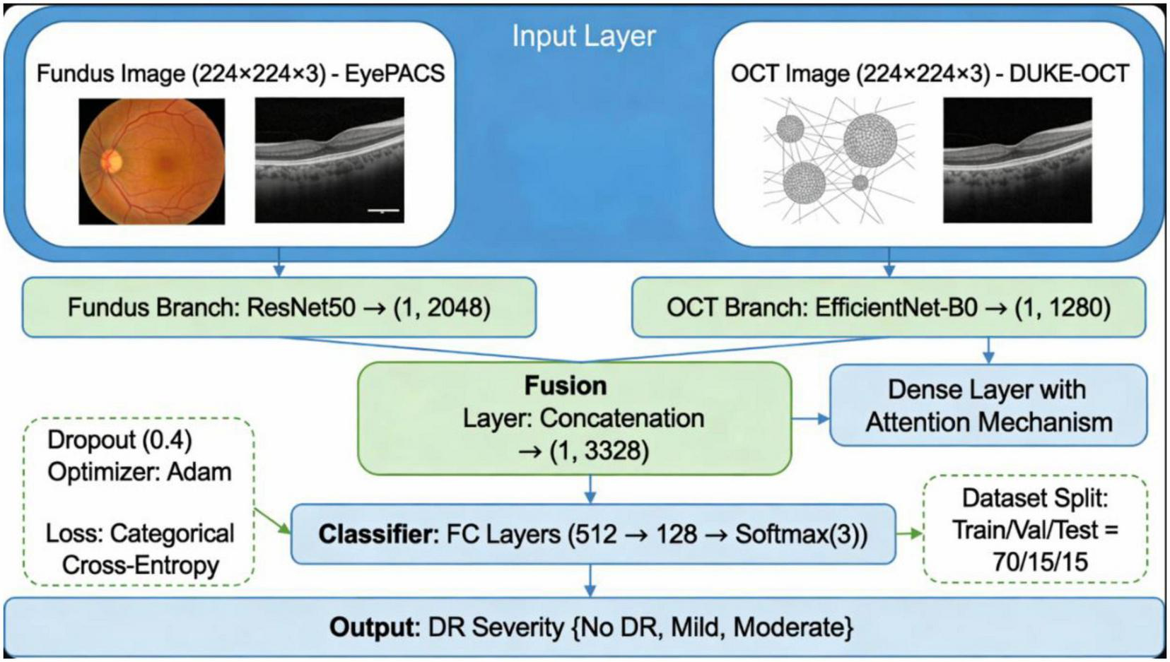Diagram of a neural network model for diabetic retinopathy (DR) detection. Inputs are fundus and OCT images processed through ResNet50 and EfficientNet-B0 branches, respectively. Outputs are concatenated and fed into dense layers. The classification uses dropout, Adam optimizer, and cross-entropy loss, with a dataset split of 70% training, 15% validation, and 15% testing. The final output categorizes DR severity as no DR, mild, or moderate.