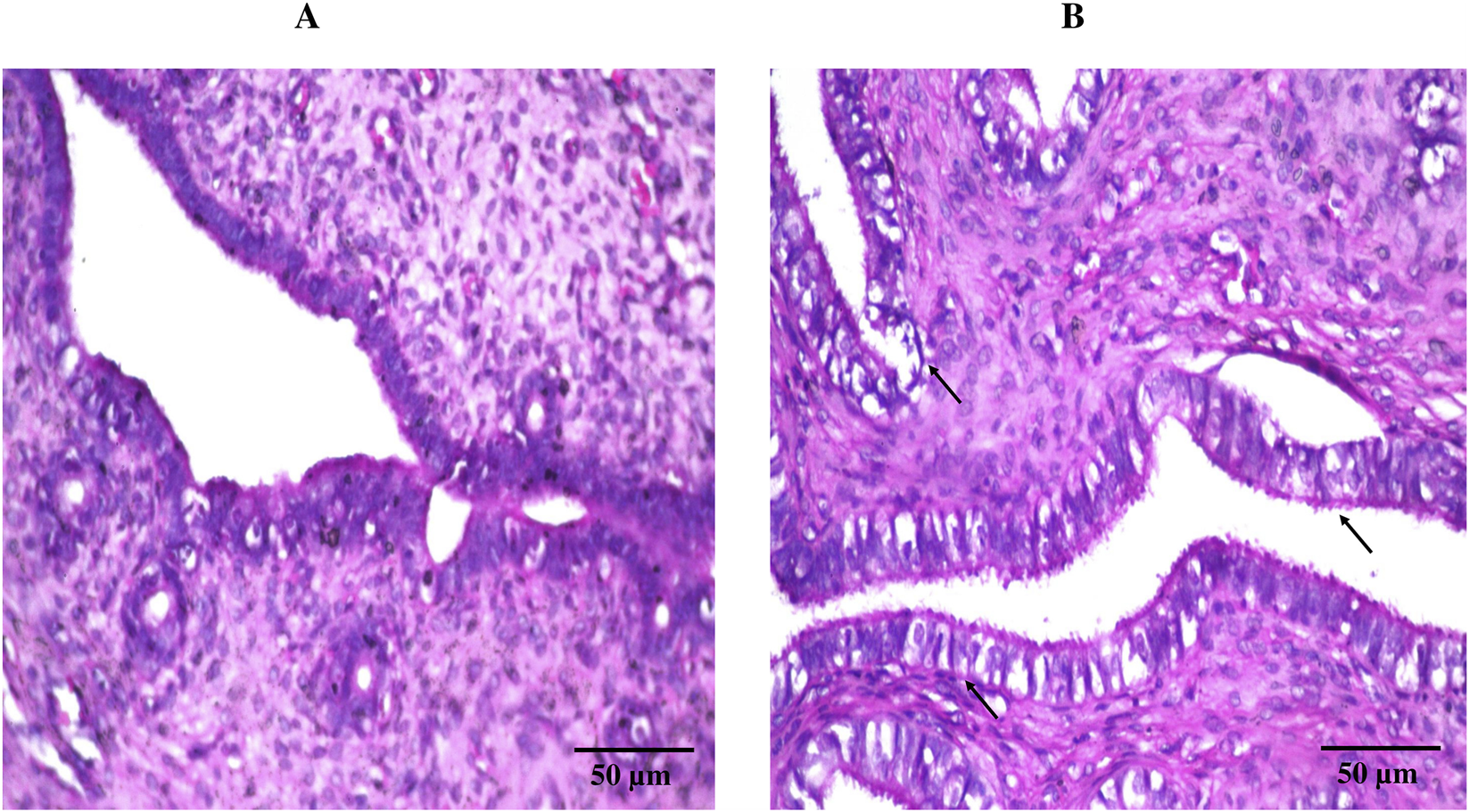 Histopathological images of (A) control group (left untreated) and (B) treatment group (DHCPP gel), highlighting normal tissue structure in both groups.