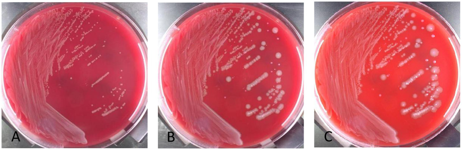 Three petri dishes labeled A, B, and C show bacterial colonies on red agar. Each dish exhibits varying colony sizes and densities, with streak patterns evident from left to right.